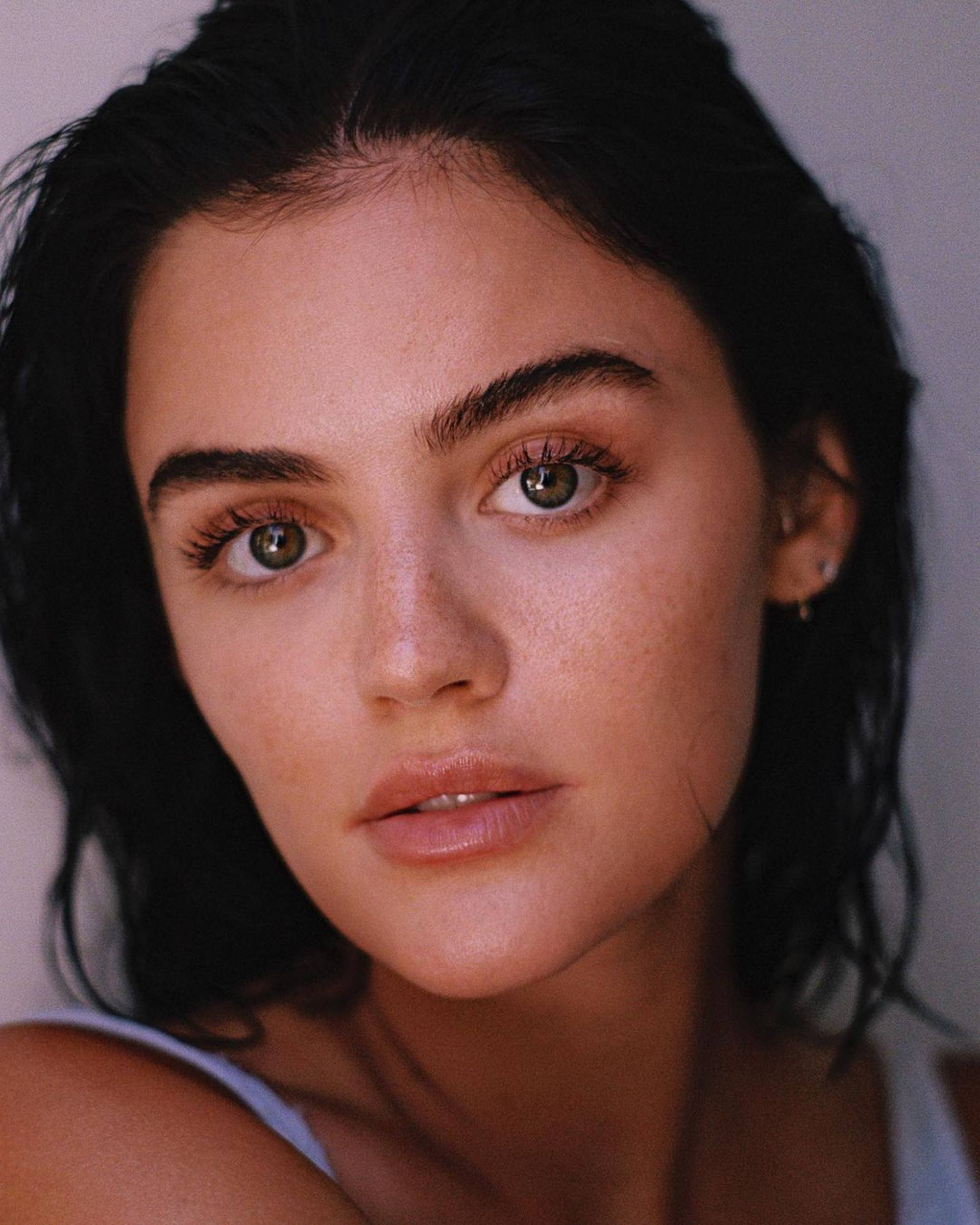 Celebrities With Bad Skin 2024