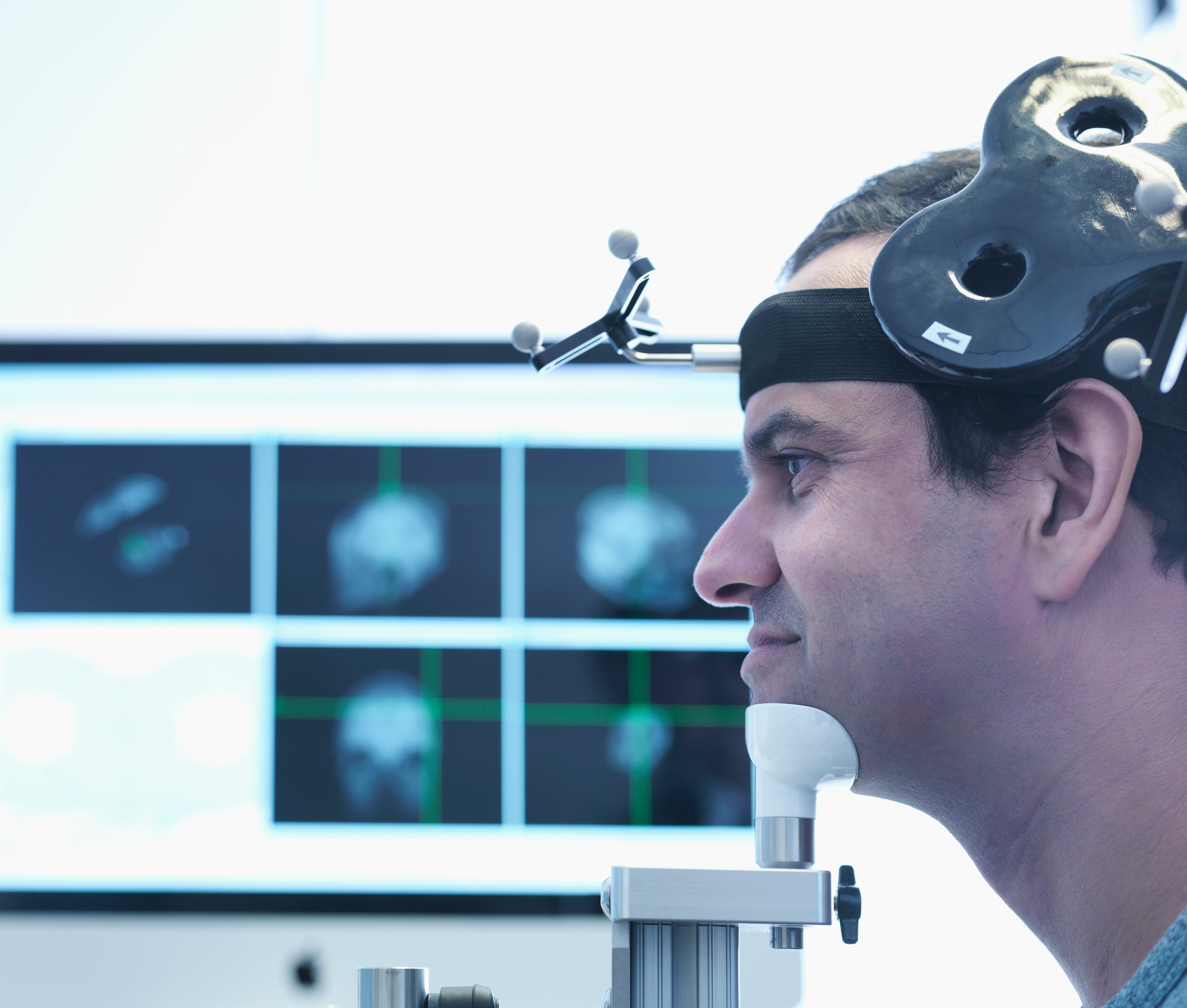 Transcranial magnetic stimulation (TMS) stimulates and resets specific areas of the brain to provide relief from OCD symptoms. Photo: Shutterstock