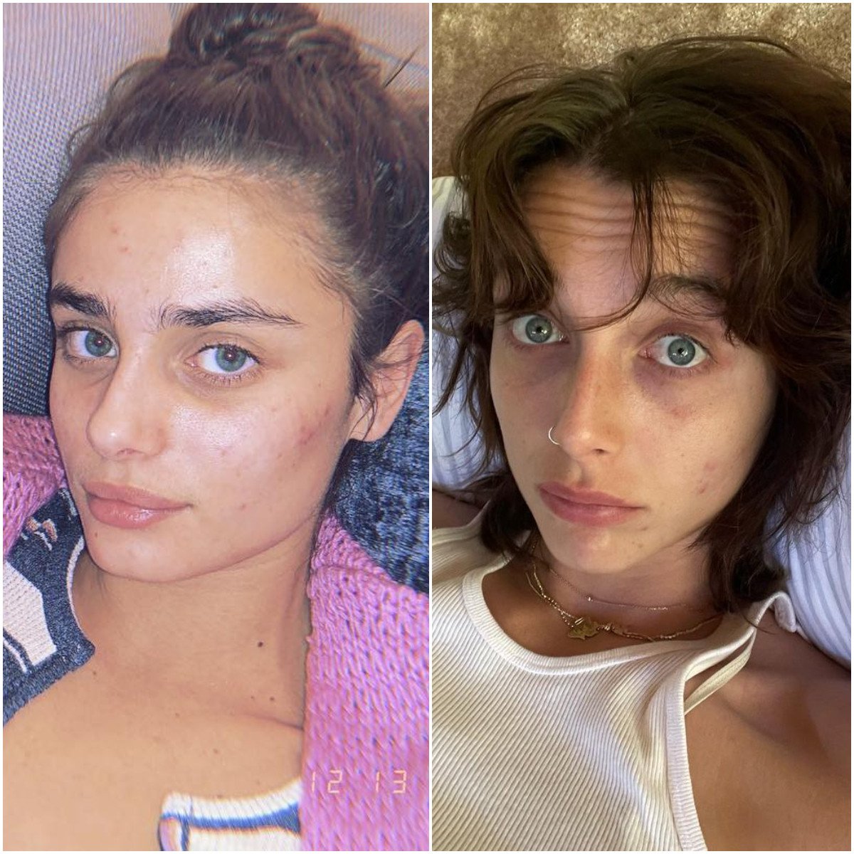 Taylor Hill and Emma Chamberlain are among the celebrities who have spoken out about their acne. Photos: @taylor_hill, @emmachamberlain/Instagram