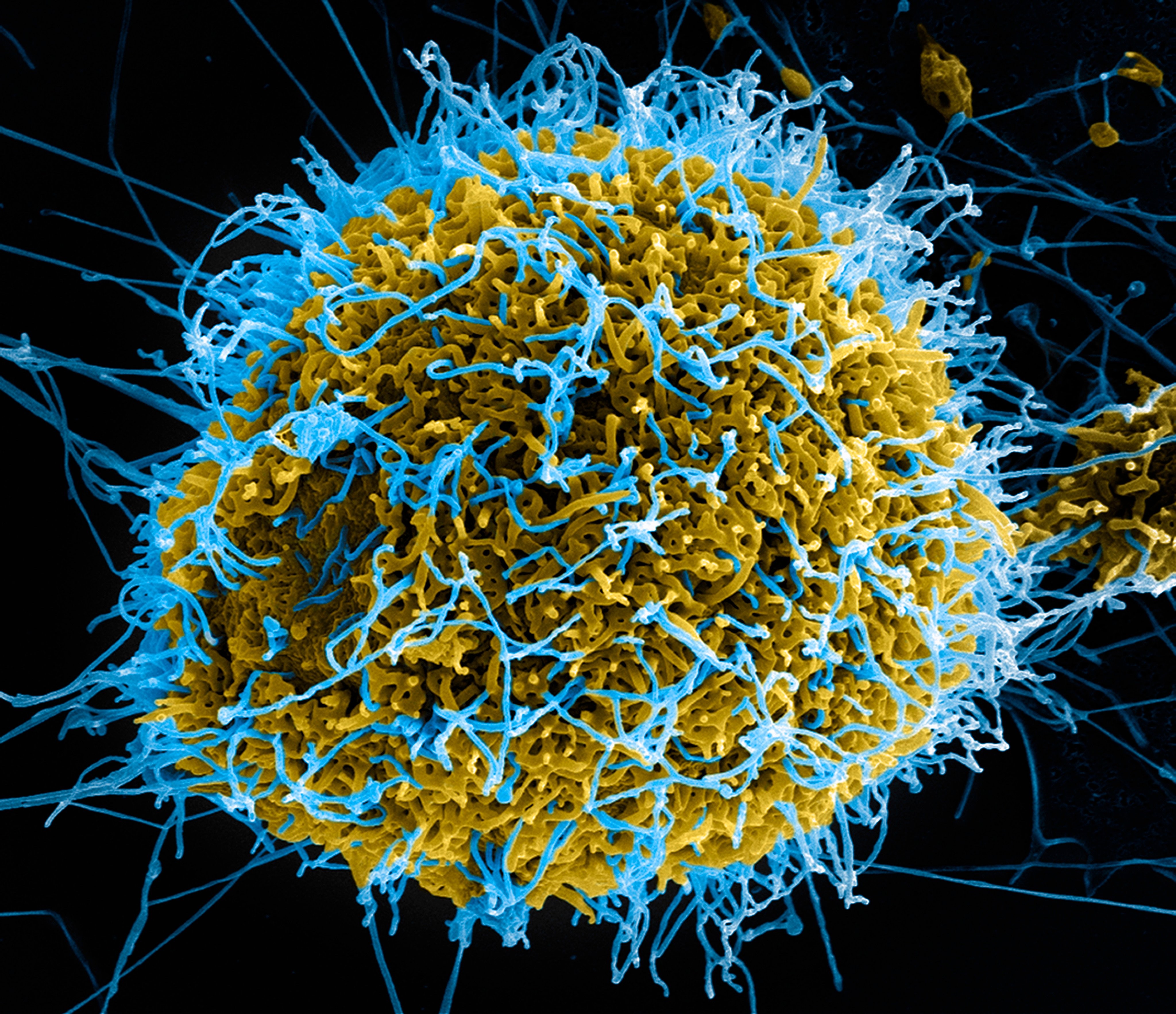 Ebola virus particles (blue) forming from an infected VERO E6 cell (yellow). Photo: Getty Images/Cultura RF