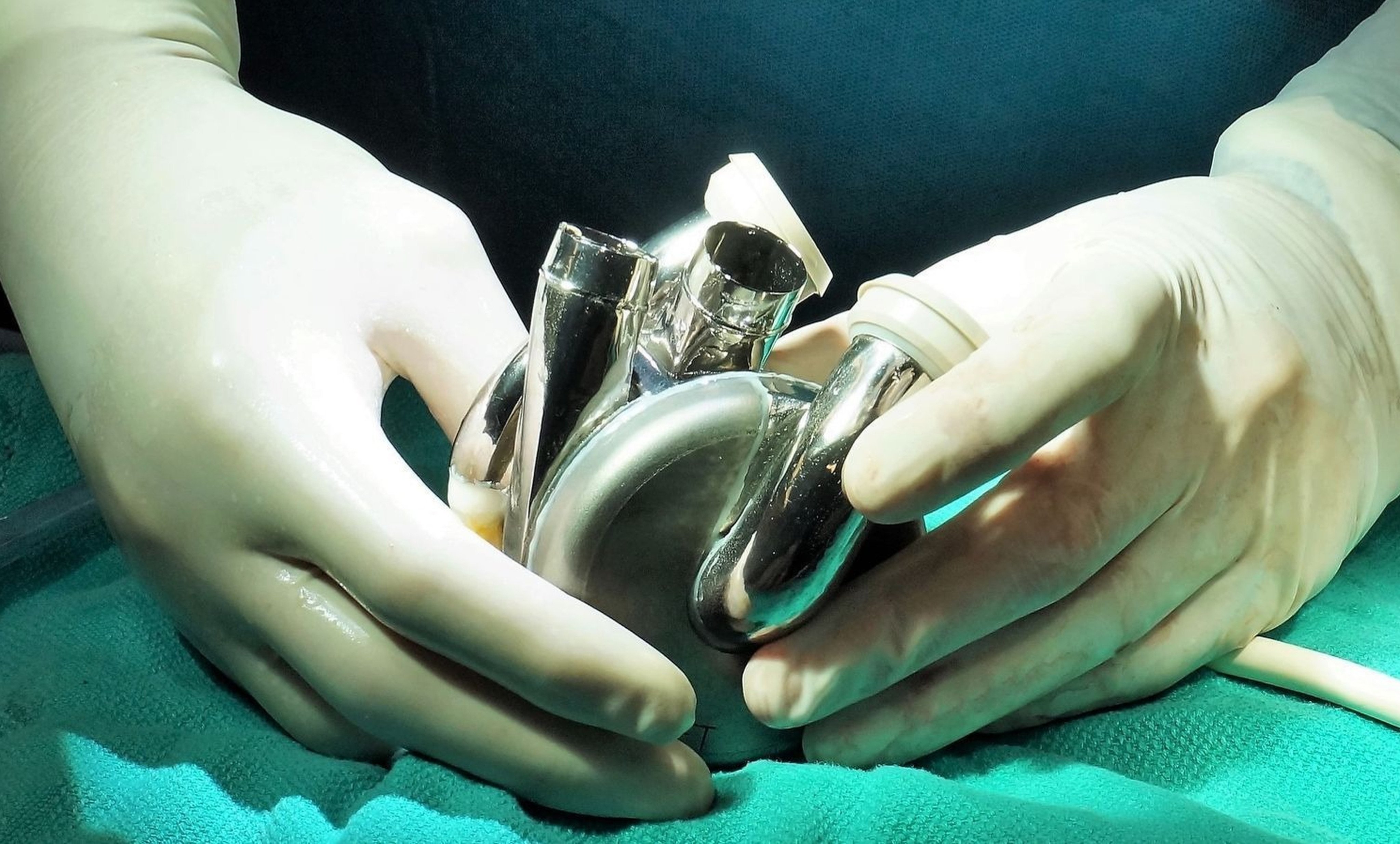 A BiVacor artificial heart. Its makers say the long-term goal is for patients to live with the device indefinitely without needing a transplant. Photo: BiVacor