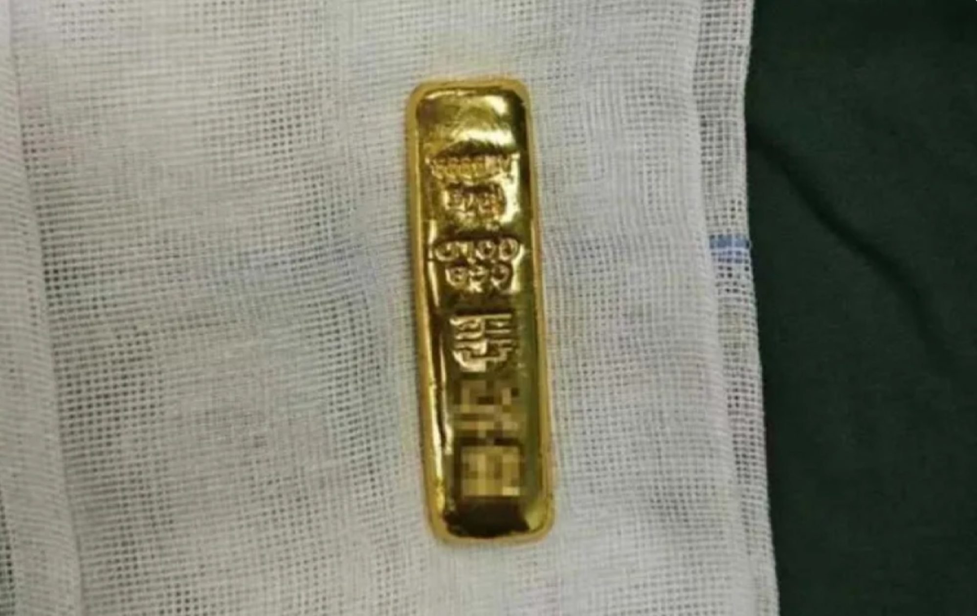 It took two surgeons just 30 minutes to remove the bar, despite the challenges posed by its significant size and smooth surface. Photo: Douyin It took two surgeons just 30 minutes to remove the bar, despite the challenges posed by its significant size and smooth surface. Photo: Douyin