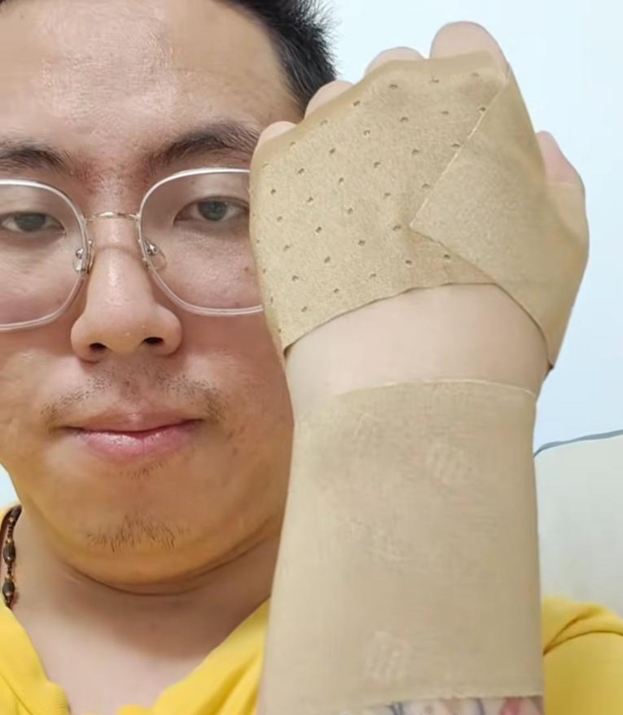 Jasmine’s Dad shows the wrist brace he is forced to wear because of his joint problems. Photo: Baidu