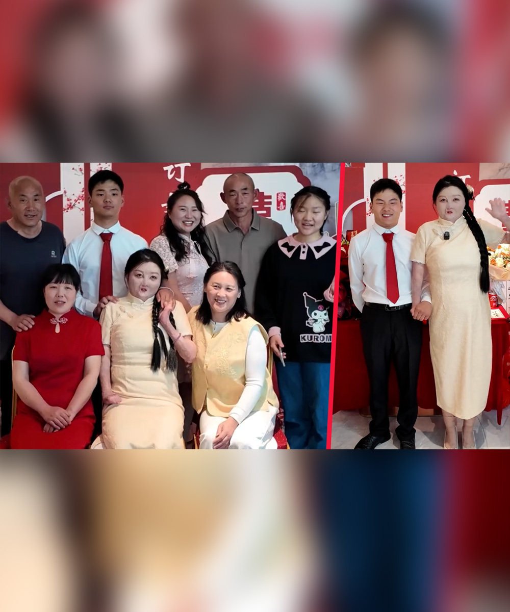 A woman in China who suffered horrific burns in a kitchen fire when she was young has revealed that she and her fiance share the same birthday. Photo: SCMP composite/Douyin