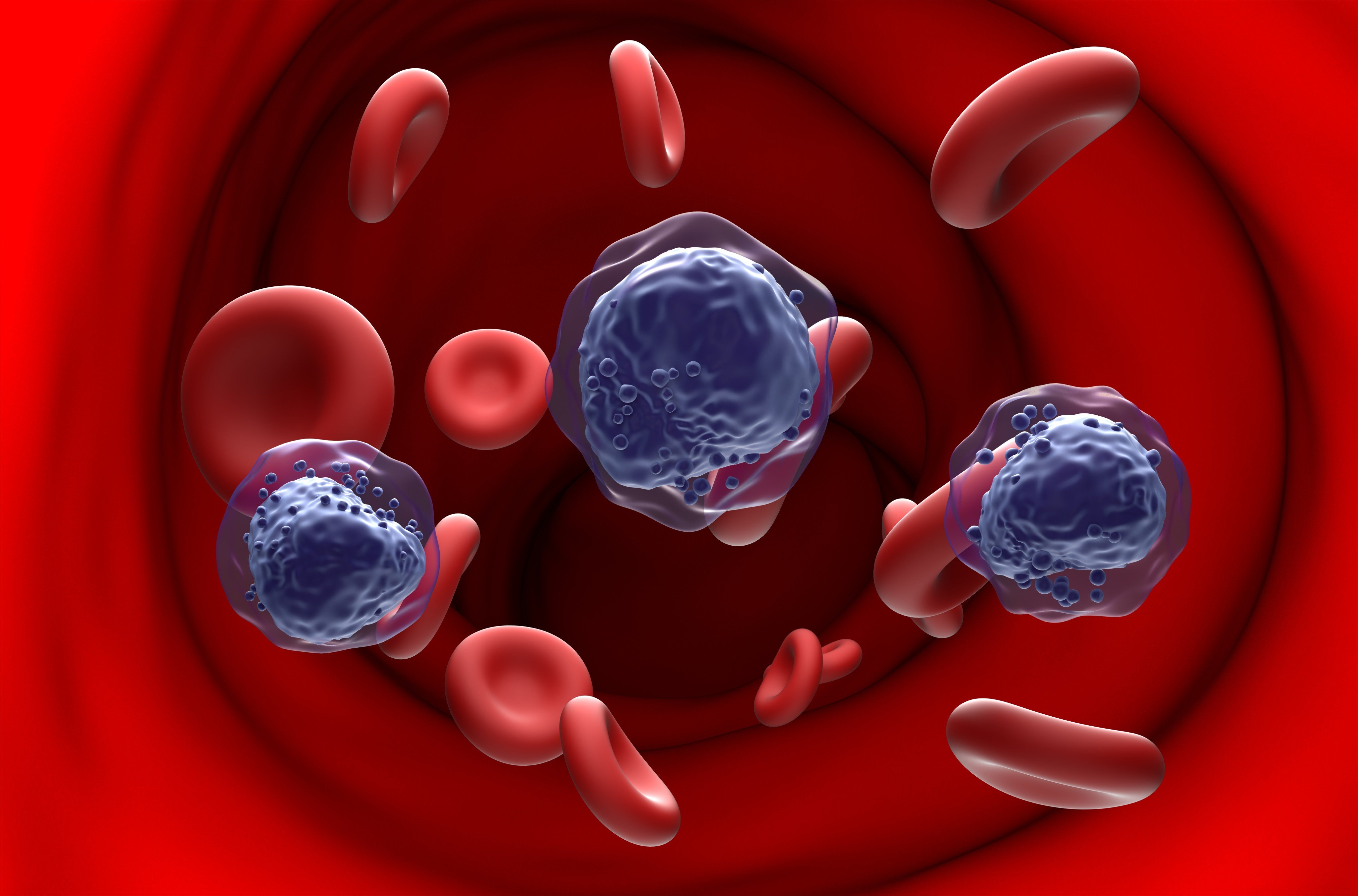 AML (acute myeloid leukaemia) is a cancer that causes the bone marrow to produce a large number of abnormal blood cells, like these pictured in purple. Illustration: Shutterstock