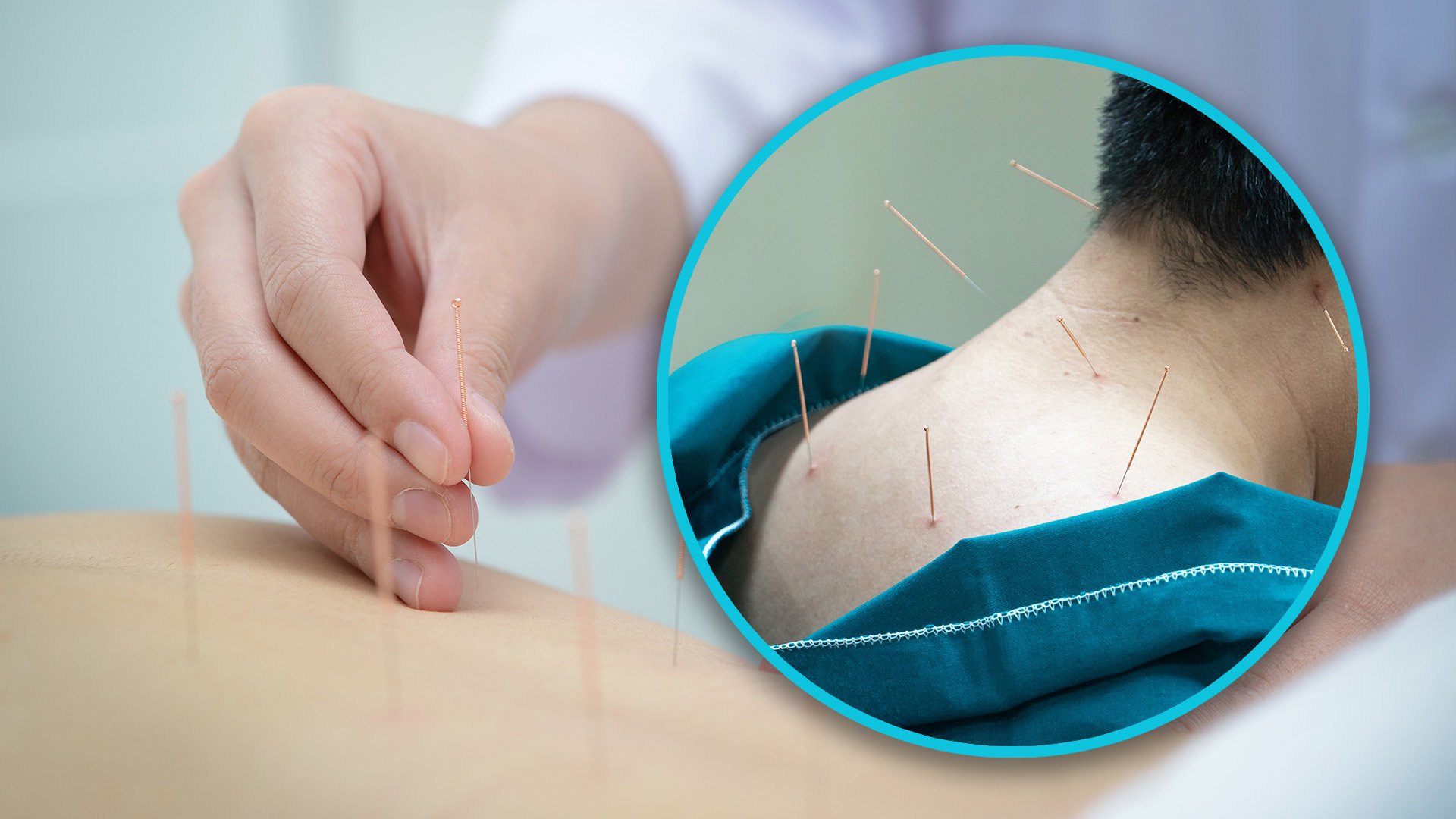 A man in China placed his trust in an unqualified doctor to treat a benign tumour and almost died as a result. Photo: SCMP composite/Shutterstock