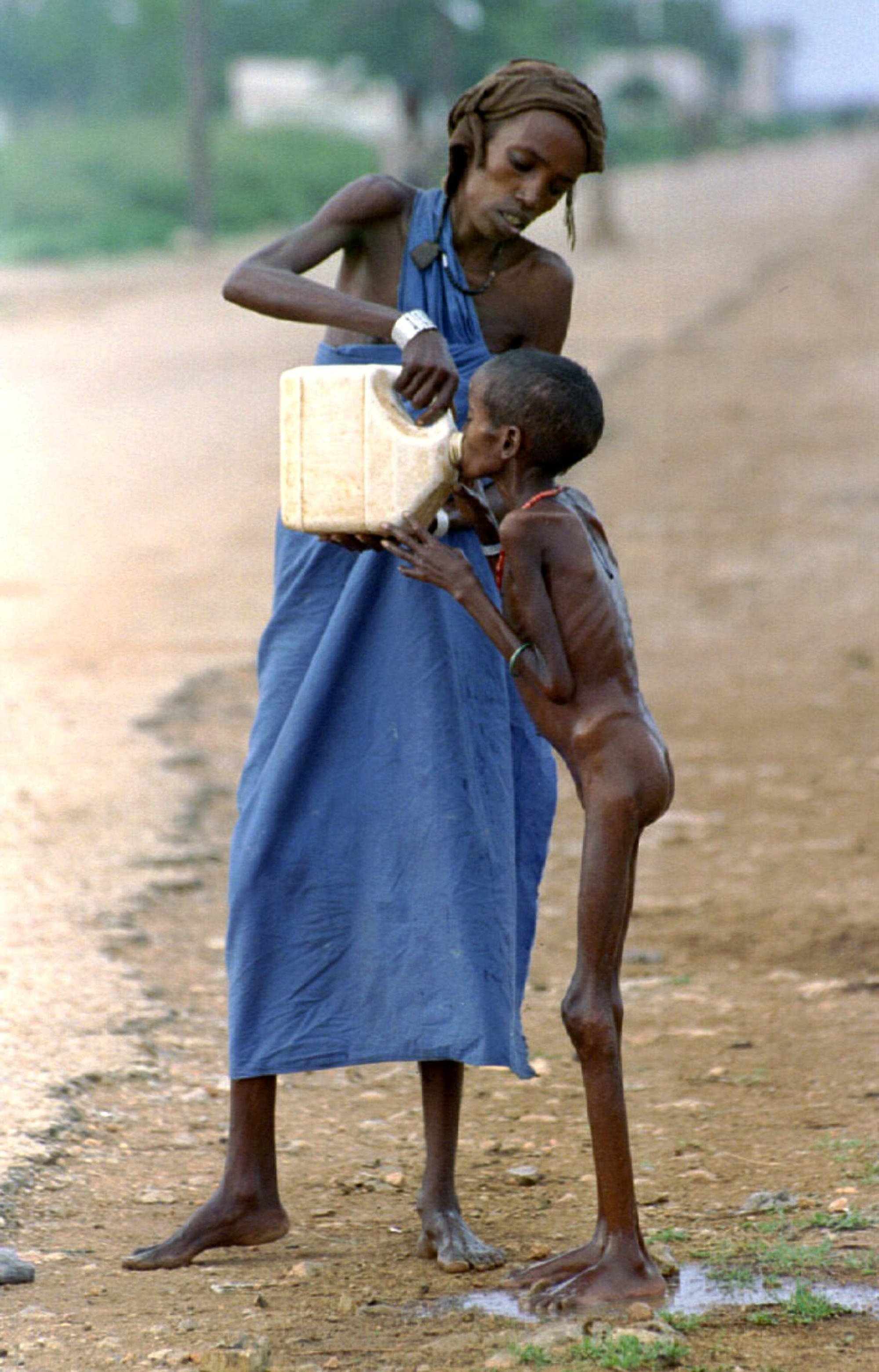 A starving Somali child is given water near a refugee camp in Baidoa, Somalia. File photo: Reuters A starving Somali child is given water near a refugee camp in Baidoa, Somalia. File photo: Reuters