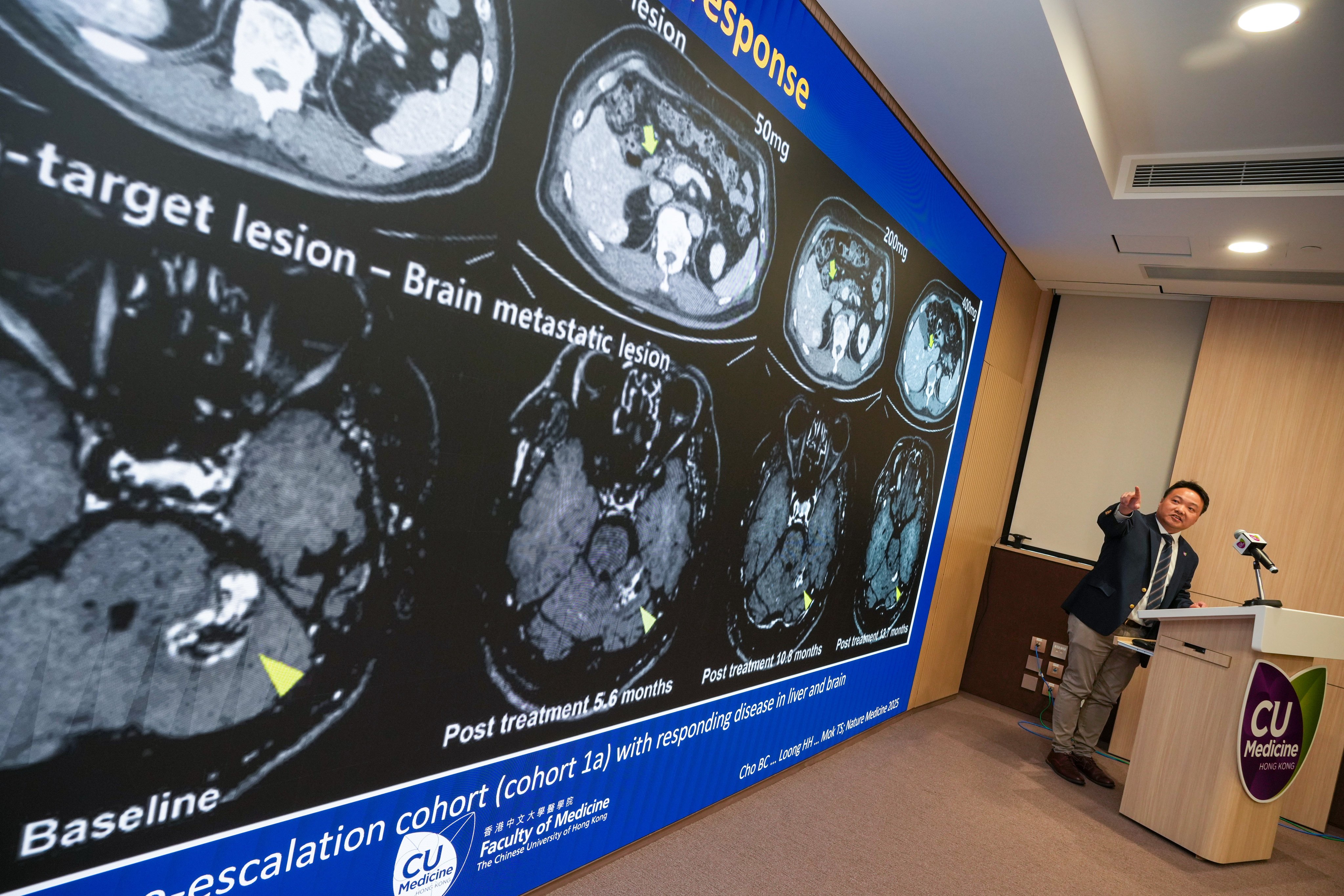 Dr Herbert Loong, an associate professor at CUHK’s clinical oncology department. shows results of the study. Photo: May Tse