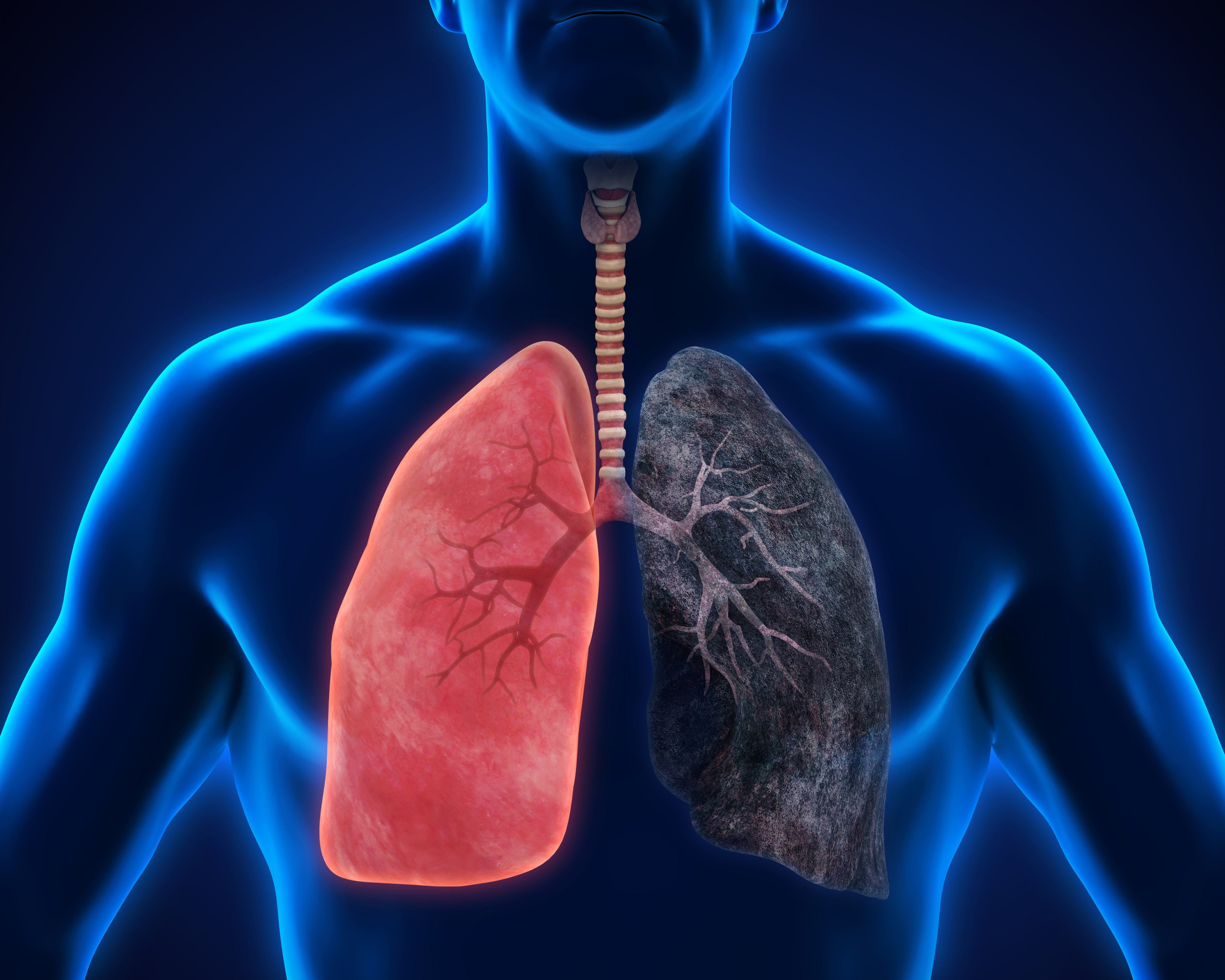 why does my nose smell like cigarette smoke Vaping causes short term damage to nose so only exhale through mouth