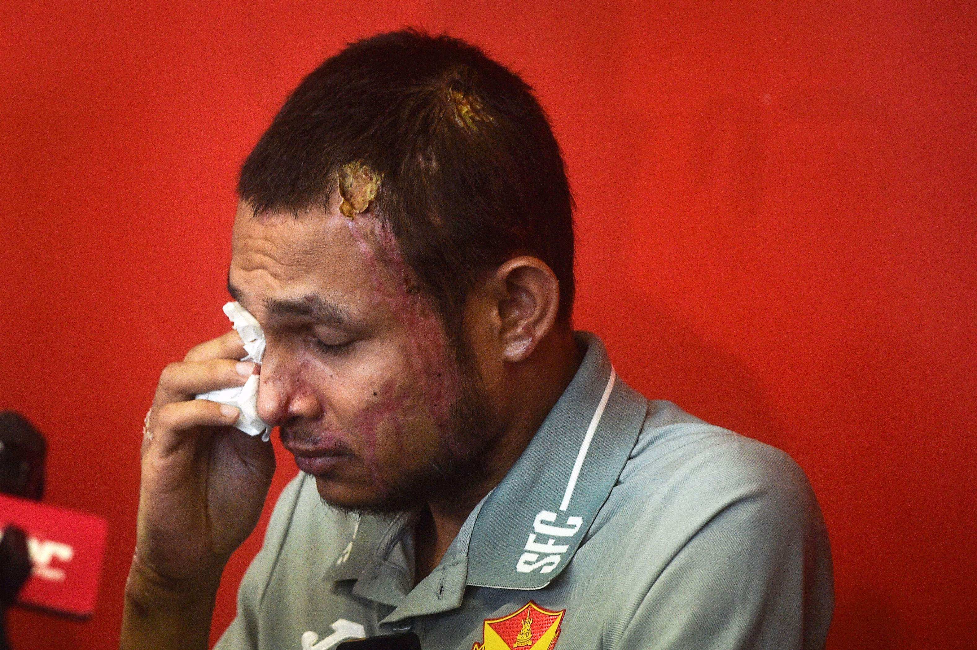 Faisal Halim was critically injured after being splashed with acid in May last year. Photo: AFP