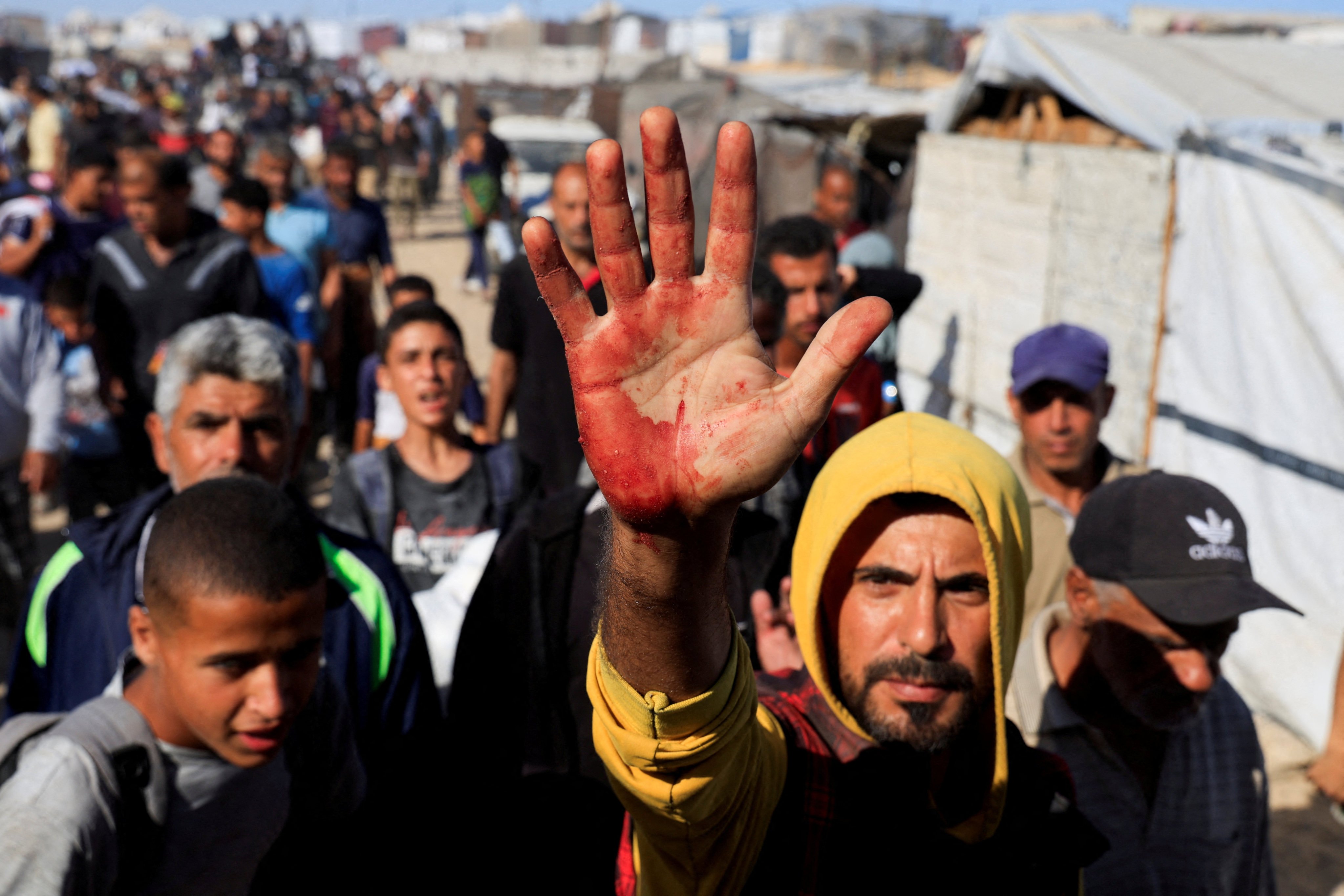 A Palestinian man shows blood stains on his palm after he carried casualties among people seeking aid supplies from the US-backed Gaza Humanitarian Foundation, in Khan Younis, southern Gaza. Photo: Reuters