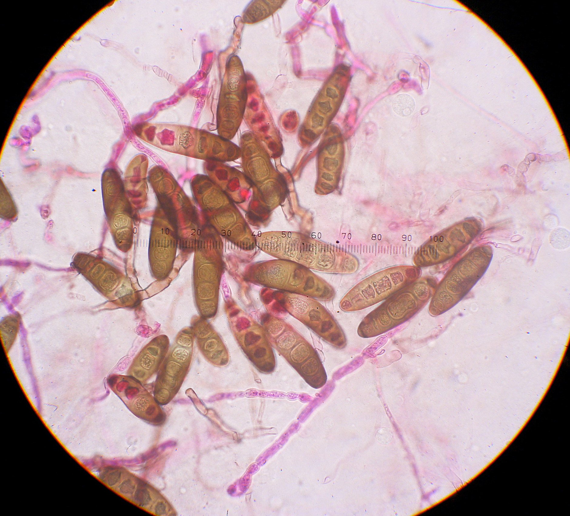 Fungal spores that can cause plant disease are viewed under a microscope. A case of alleged smuggling of a pathogen into the US has renewed concerns about a further talent exodus from the country