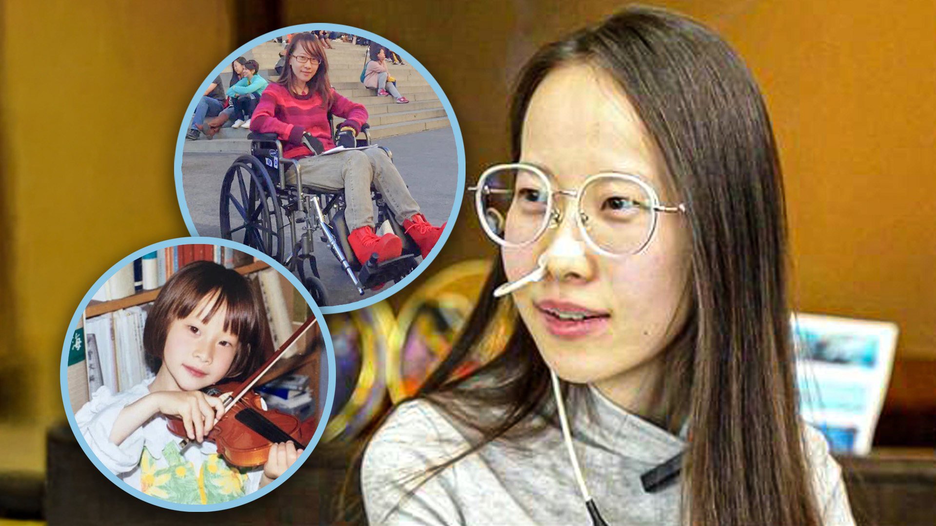 A Chinese woman with a rare disorder, which means she lives on a feeding tube and needs constant medical treatment, says she will never give up on life. Photo: SCMP composite/Douyin/Jimu
