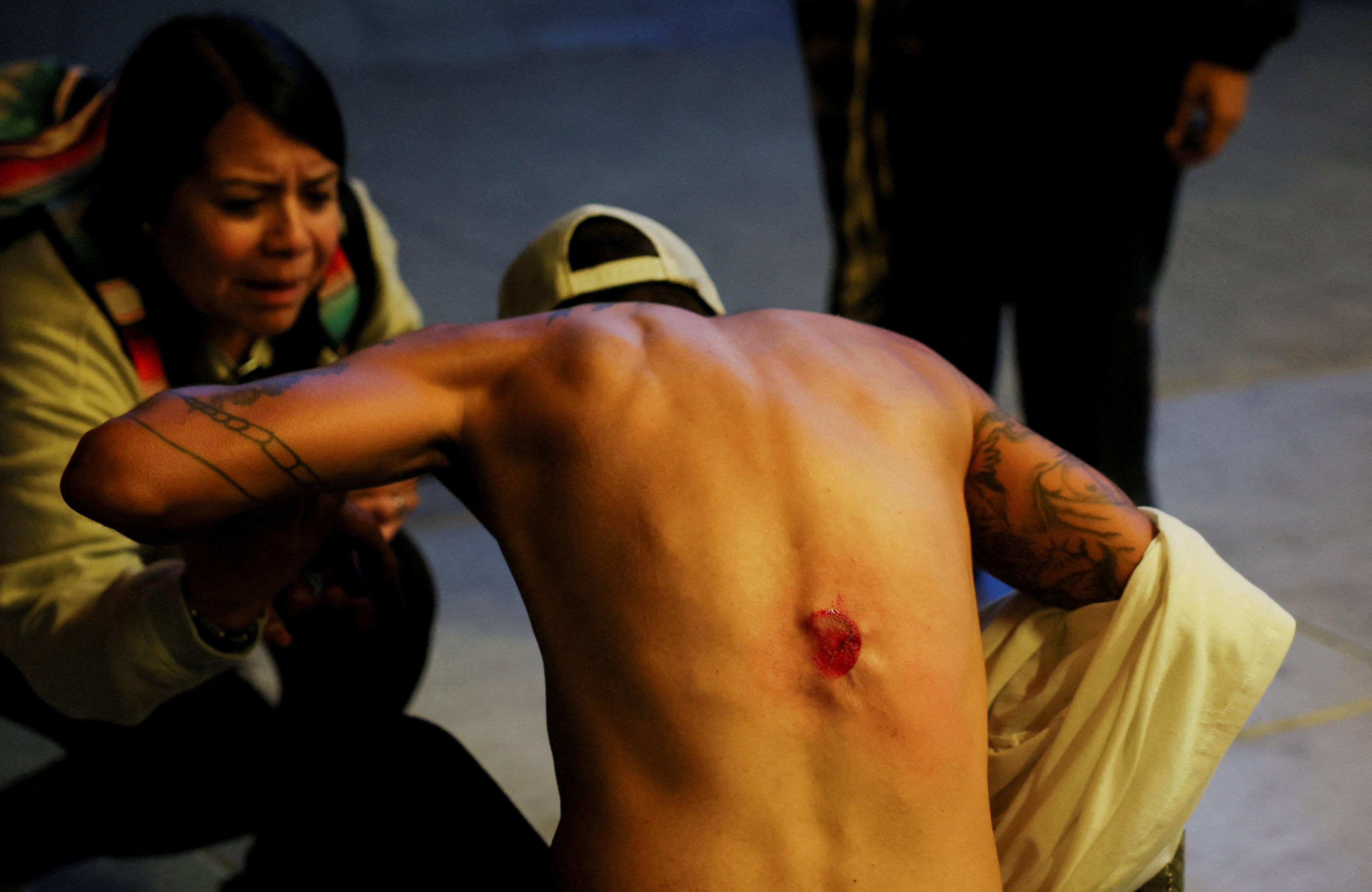 A man hit by a non-lethal munition is assisted by a woman, as people march as part of the ongoing protests against Immigration and Customs Enforcement in Los Angeles on Wednesday. Photo: Reuters