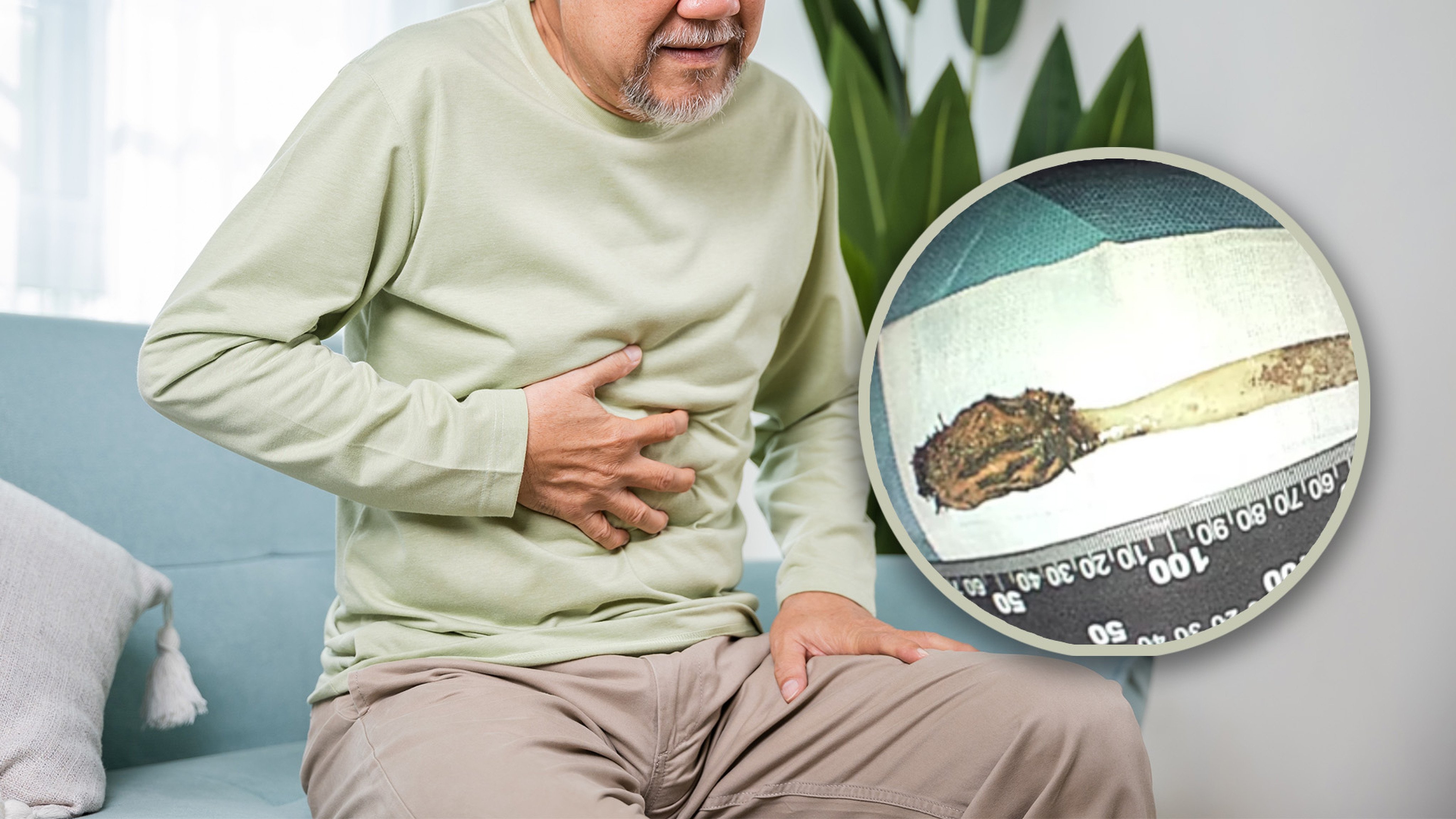 A 64-year-old man in China who swallowed a toothbrush when he was 12 years old has finally had it removed from his stomach in an 80-minute surgical procedure. Photo: SCMP composite/Shutterstock/Douyin