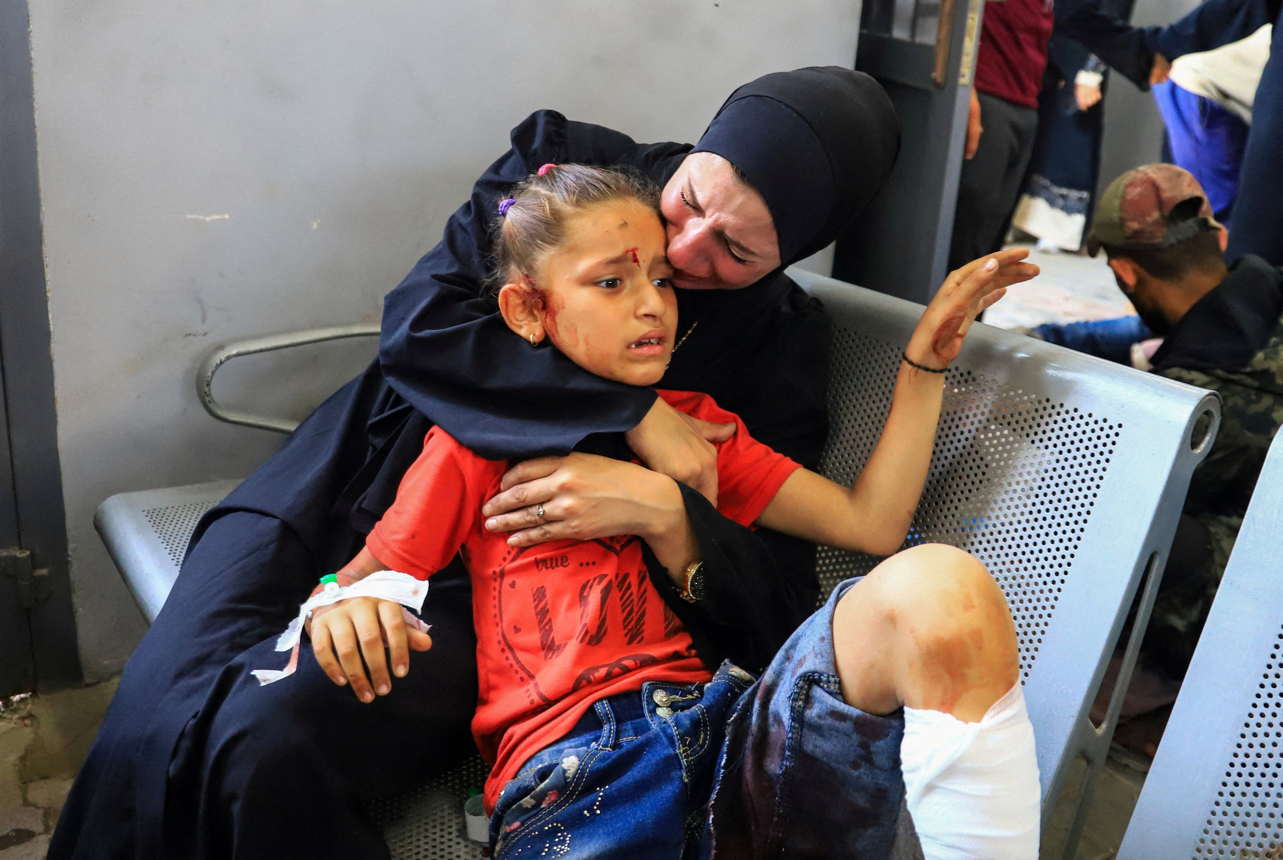A Palestinian girl, wounded in an Israeli strike, receives treatment at Al-Shifa hospital in Gaza City. Photo: Reuters