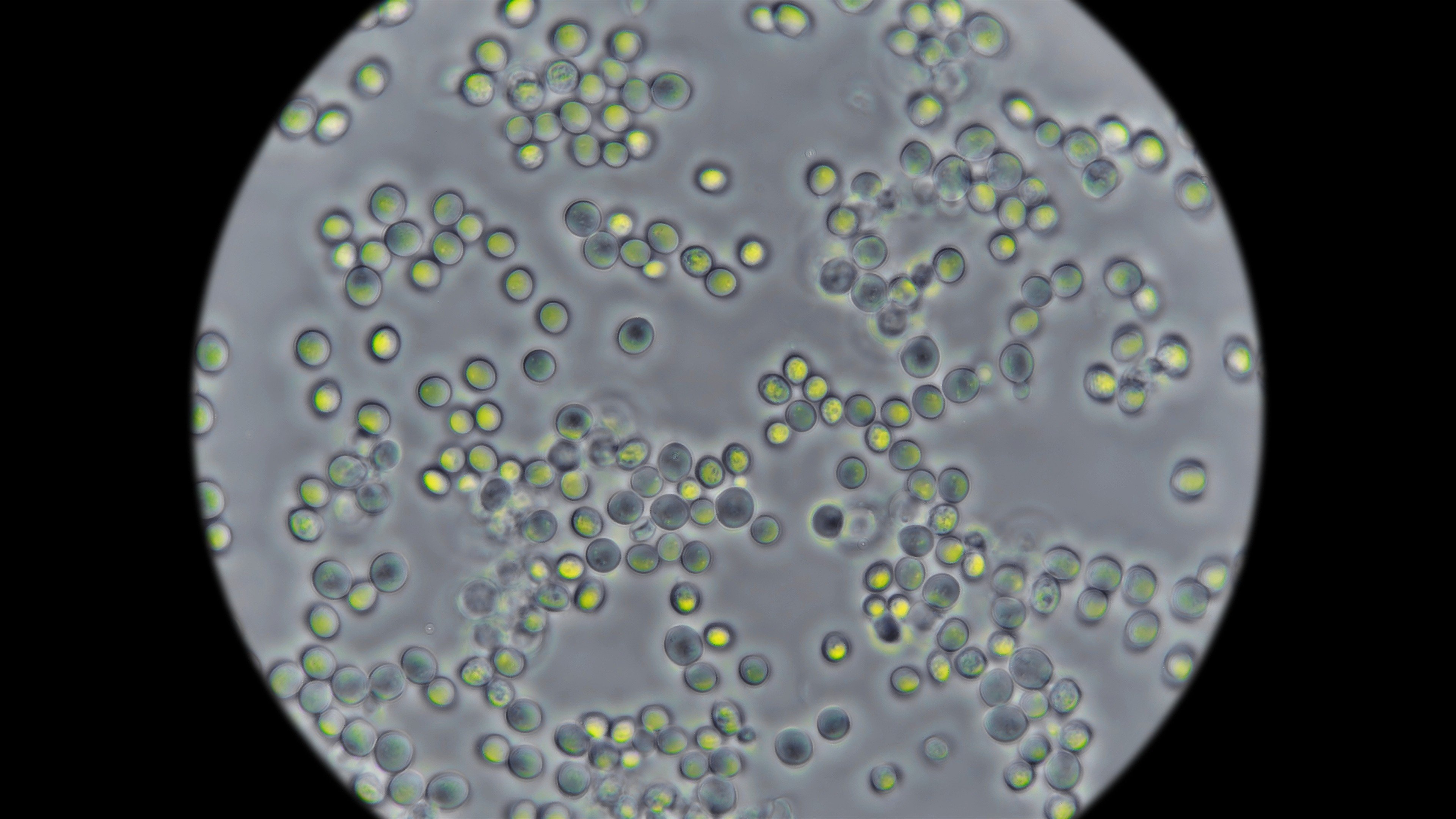 Yeast seen under a microscope. Using a mathematical analysis, Chinese researchers have unlocked new insights about cell metabolism by studying yeast. Photo: Shutterstock