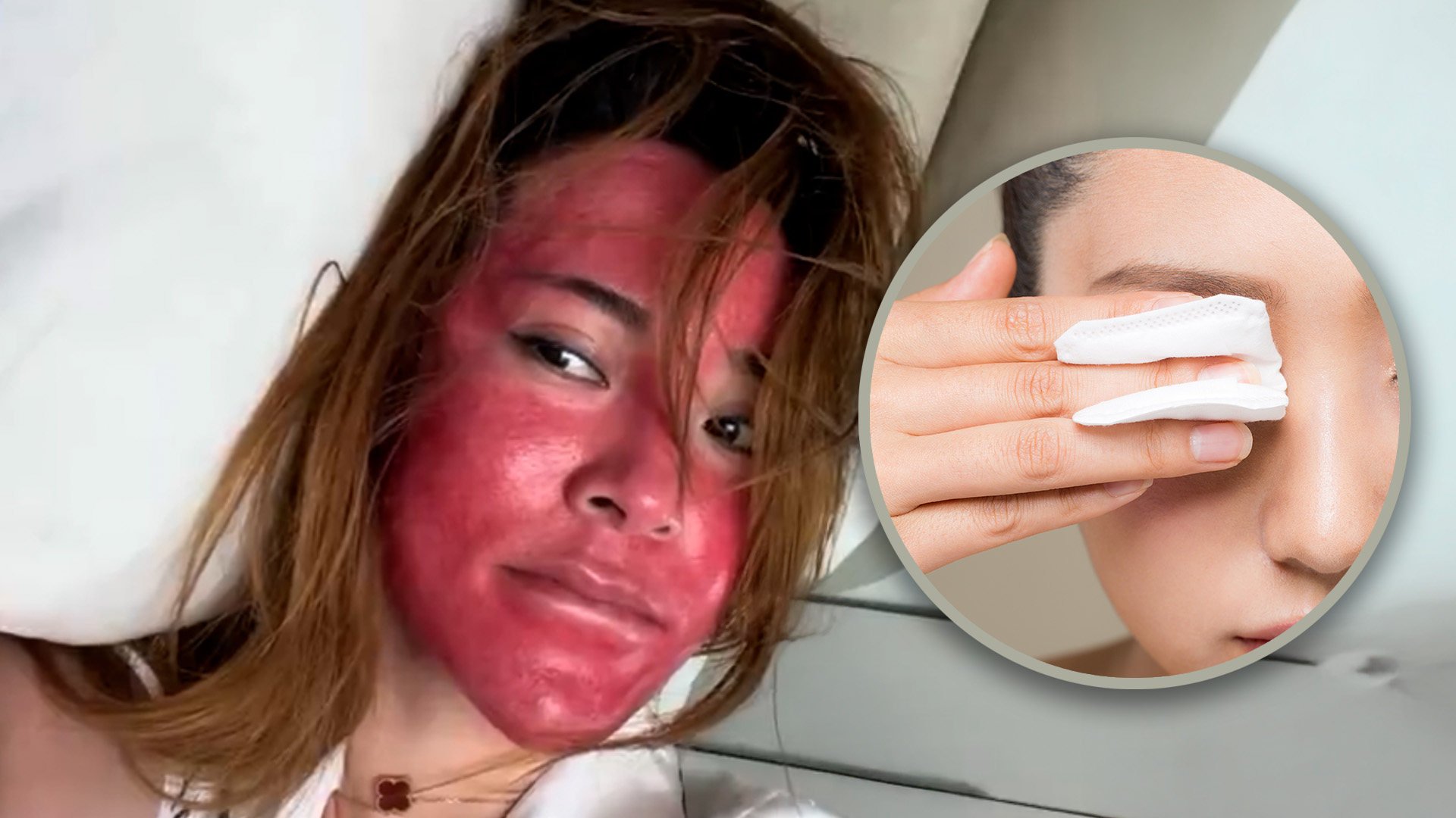 A Chinese woman has made headlines after wearing the same make-up for 22 years, leading to severe allergic reactions and significant facial swelling. Photo: SCMP composite/Shutterstock/Weibo