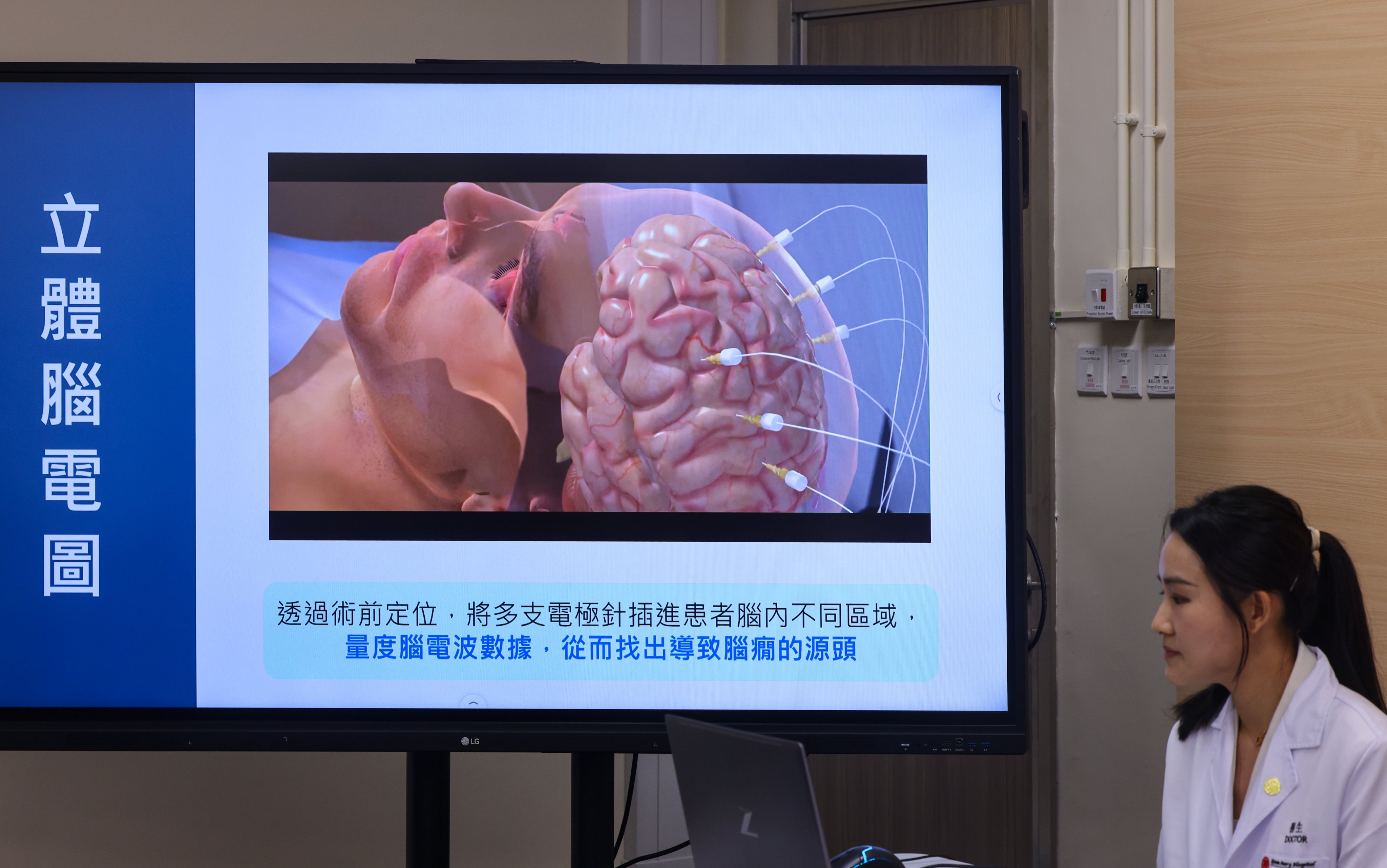 The new robotic system means doctors in Hong Kong can use a more accurate and less invasive approach to identify the sources of epilepsy conditions that are untreatable with medication. Photo: Nora Tam