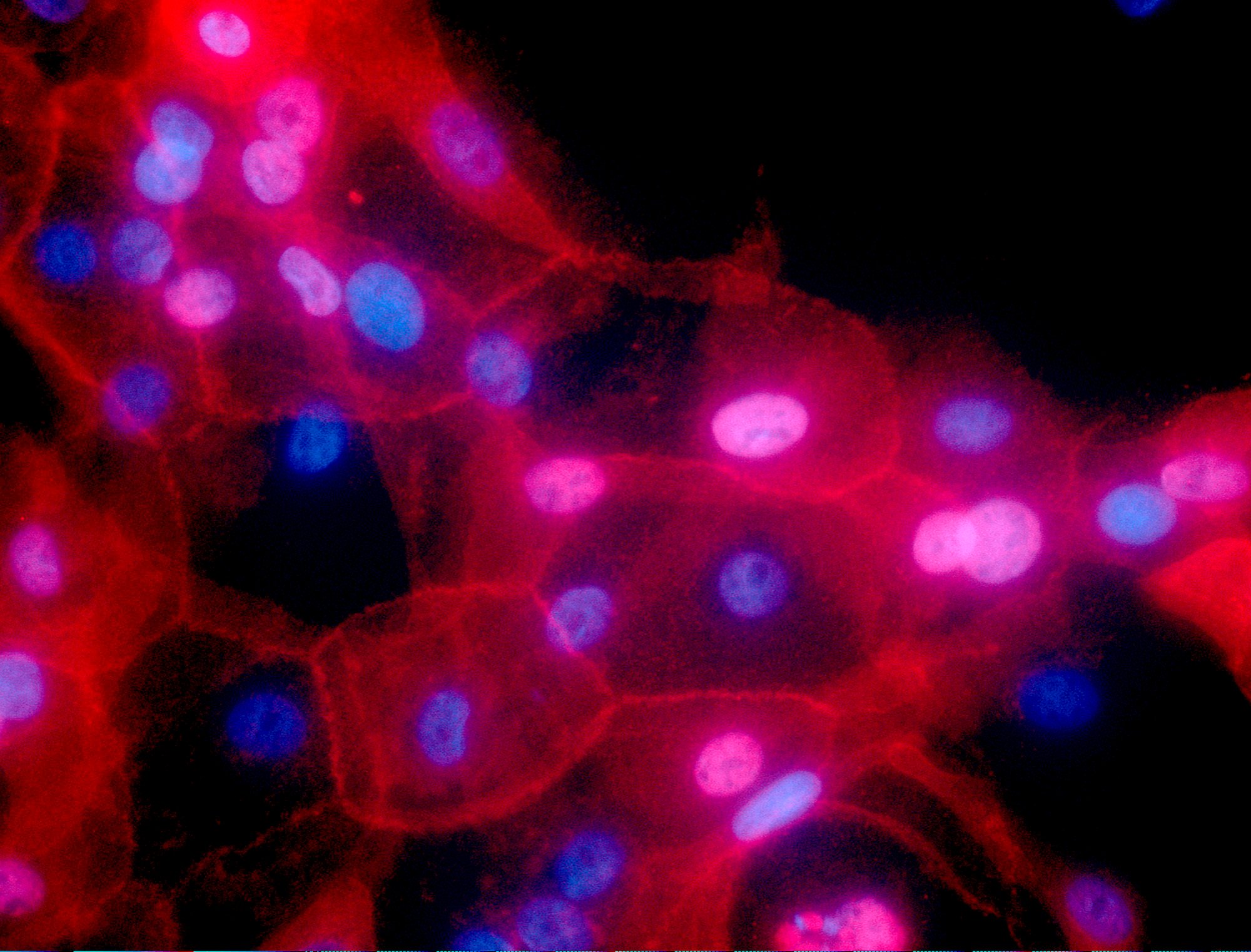 Team based in China also finds that the use of specific drugs in combination with chemotherapy could be used to inhibit this process in mice, with a clinical trial already under way in breast cancer patients. Photo: AP