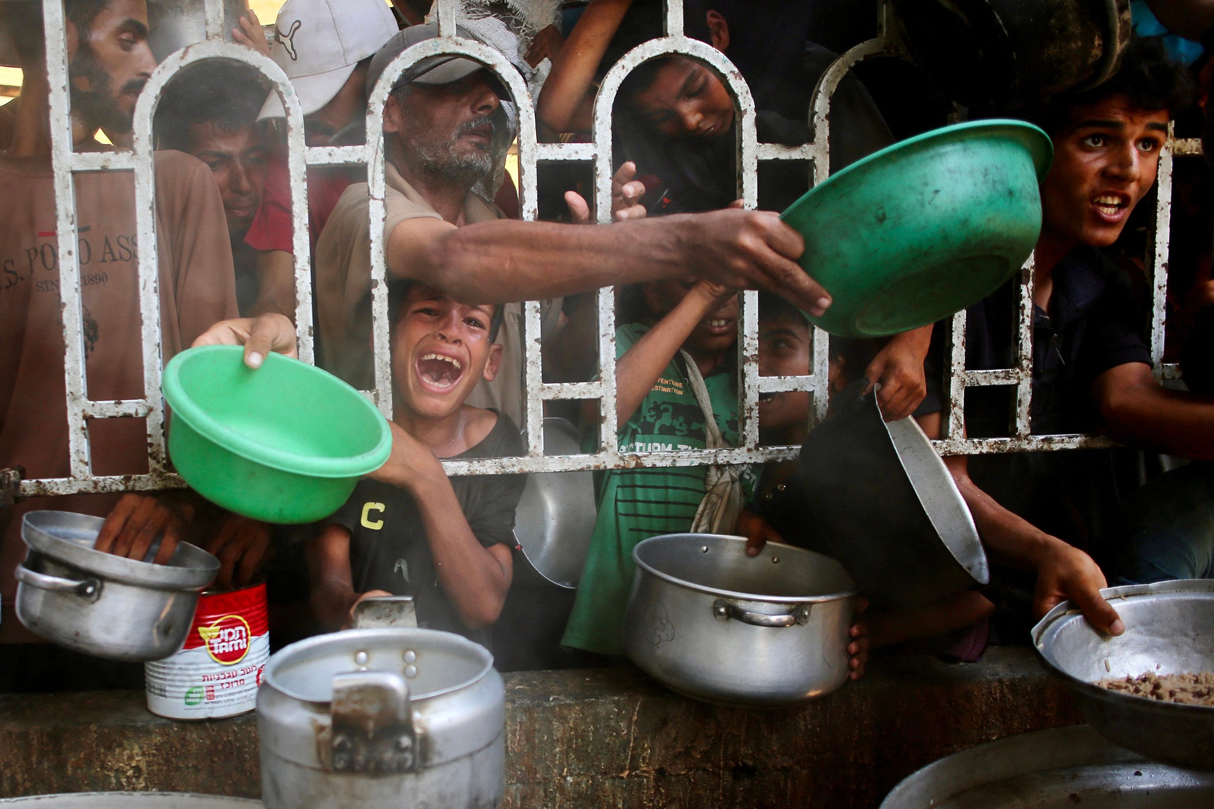 WHO warns of severe malnutrition in Gaza, urging urgent aid delivery to combat rising child malnutrition and prevent further deaths. Photo: TNS