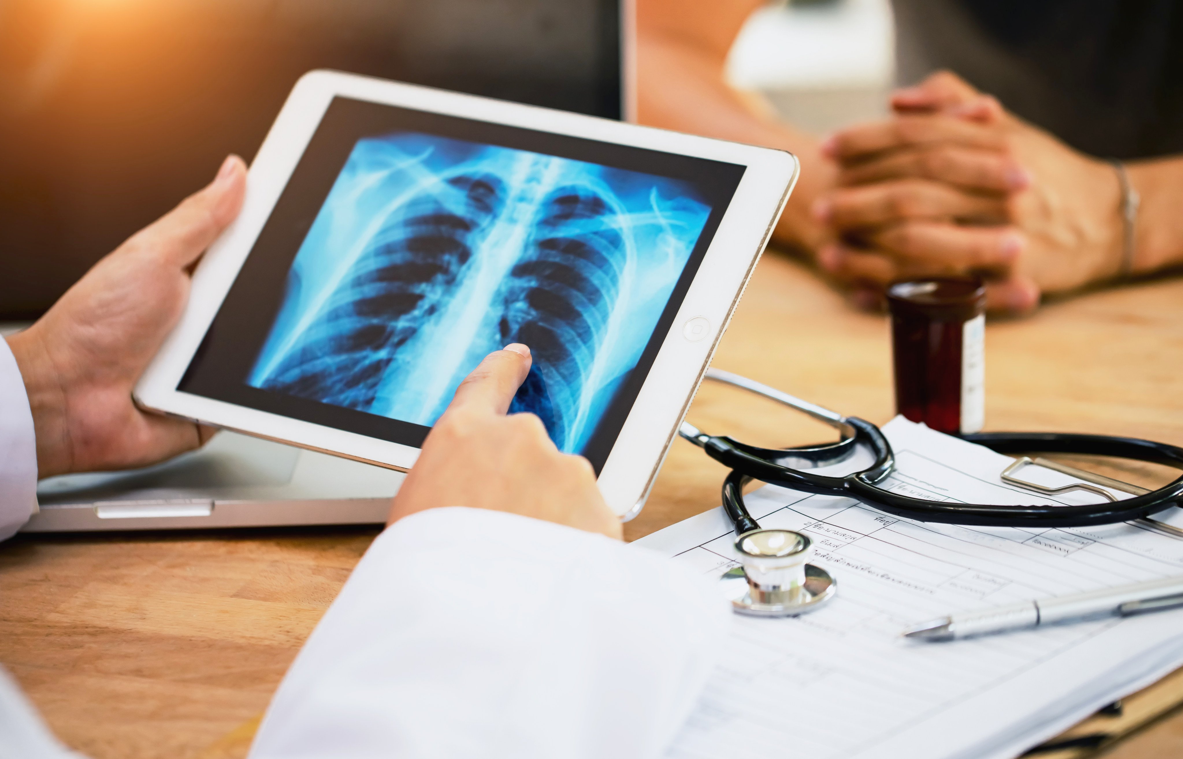 Lung cancer is the most common cancer in Hong Kong, accounting for 16.1 per cent of new cases in 2022. Photo: Getty Images