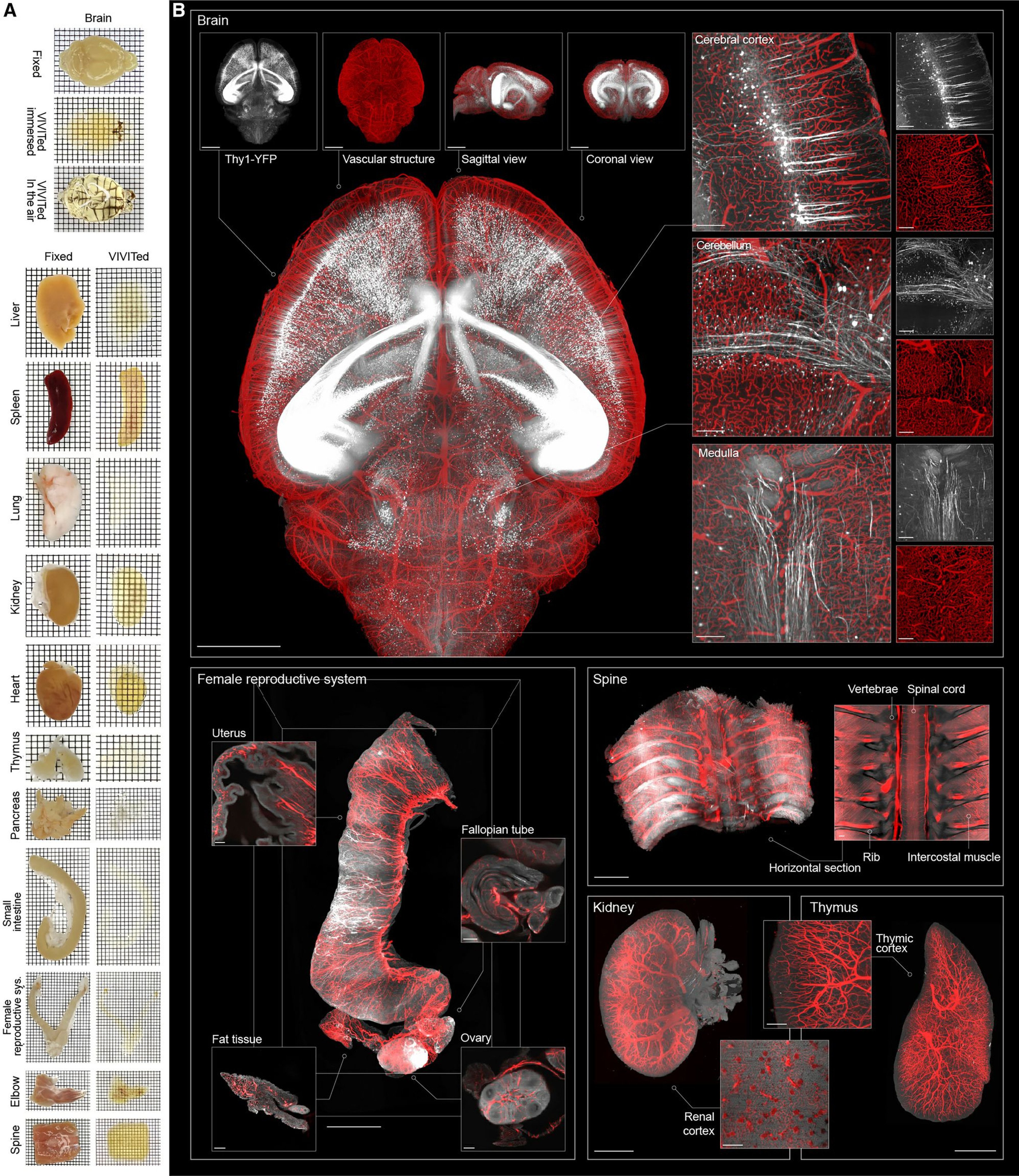 Scientists have long been looking for ways to make biological tissues transparent so that they can study organs without damaging their internal structures by cutting through them. Photo: Handout