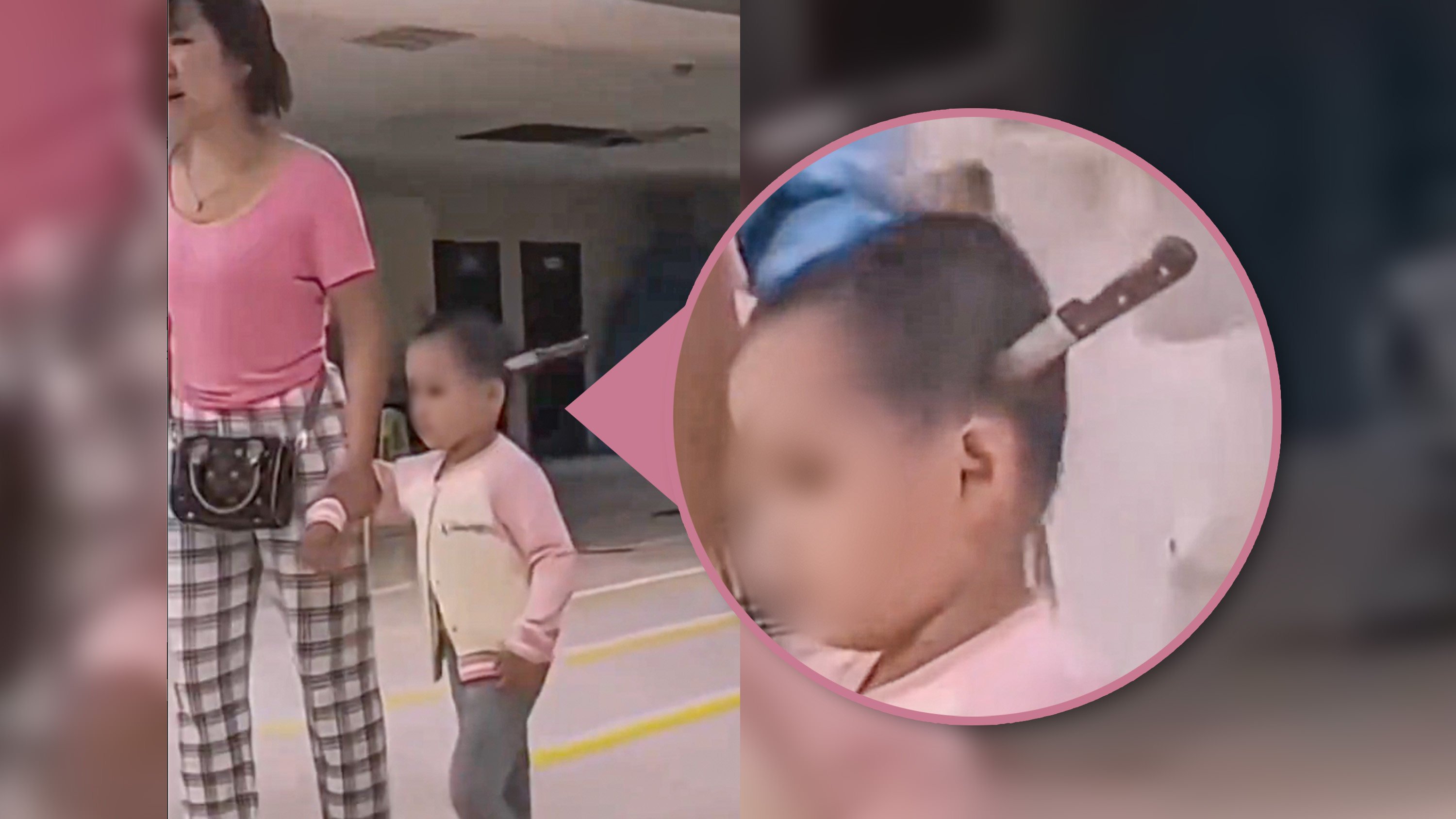A shocking online video has showed a mother taking her three-year-old daughter to the hospital with a fruit knife lodged in the child’s head. Photo: SCMP composite/Douyin