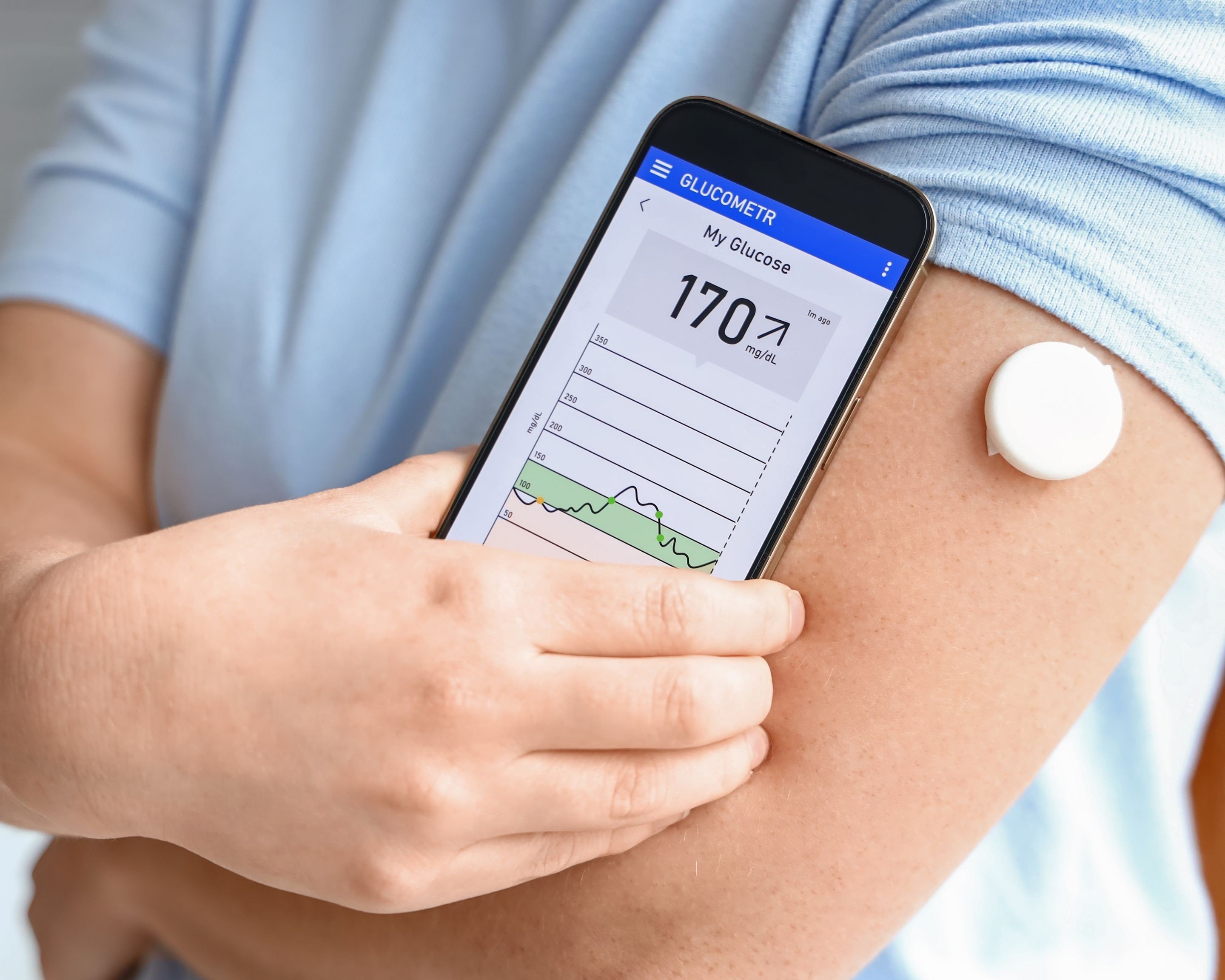 Continuous glucose monitors use tiny sensor wires inserted under the skin of your upper arm or abdomen with an applicator to measure a person’s blood sugar levels. Readings are displayed on a receiver or your smartphone. Photo: Shutterstock