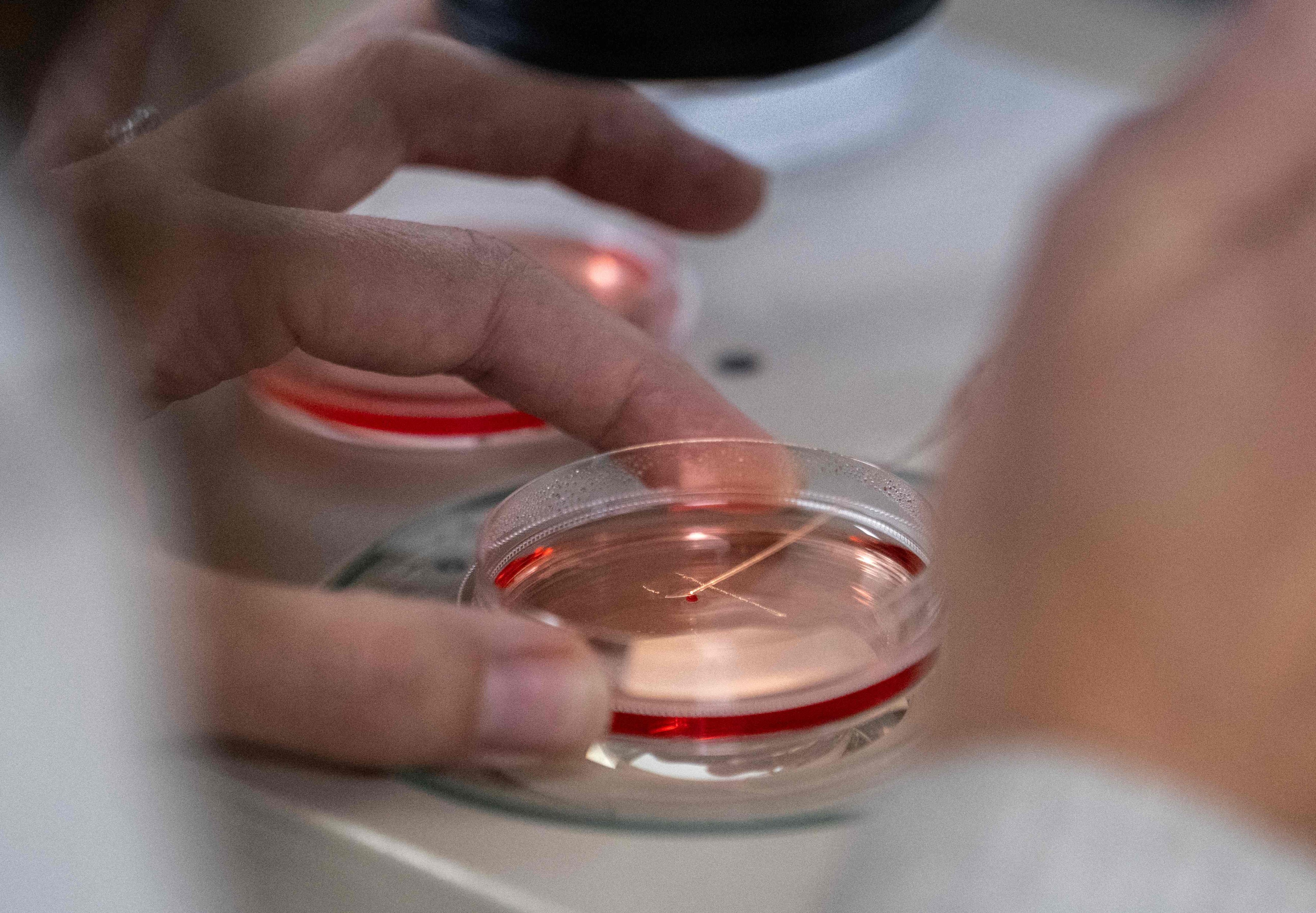 An Israeli hospital says it has achieved a breakthrough in cultivating kidneys in laboratories. Photo: AFP