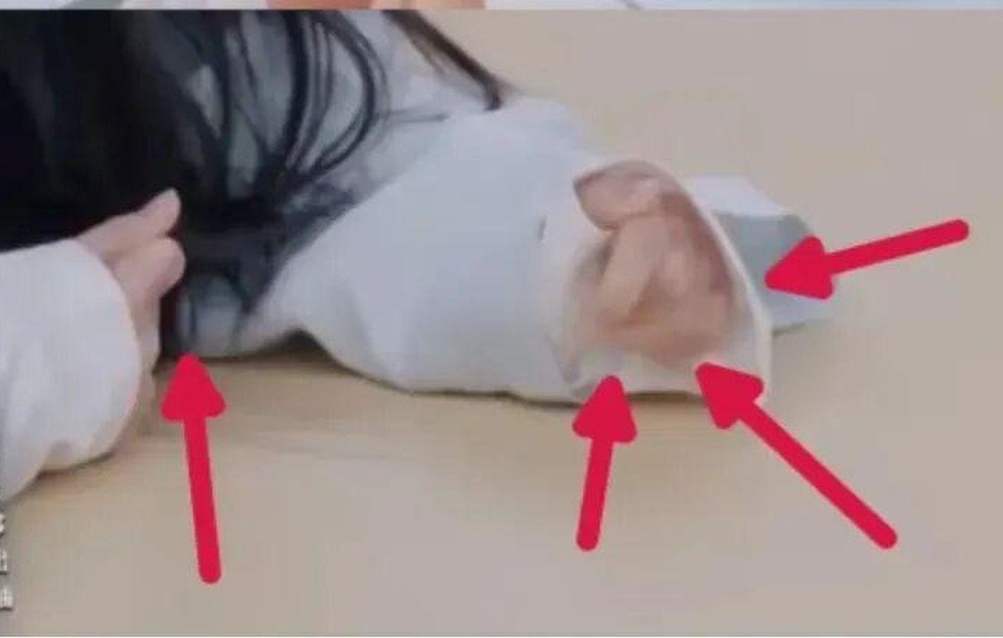 The condition the boy had was so bad that it caused him to develop “chicken claw hands”. Photo: Handout