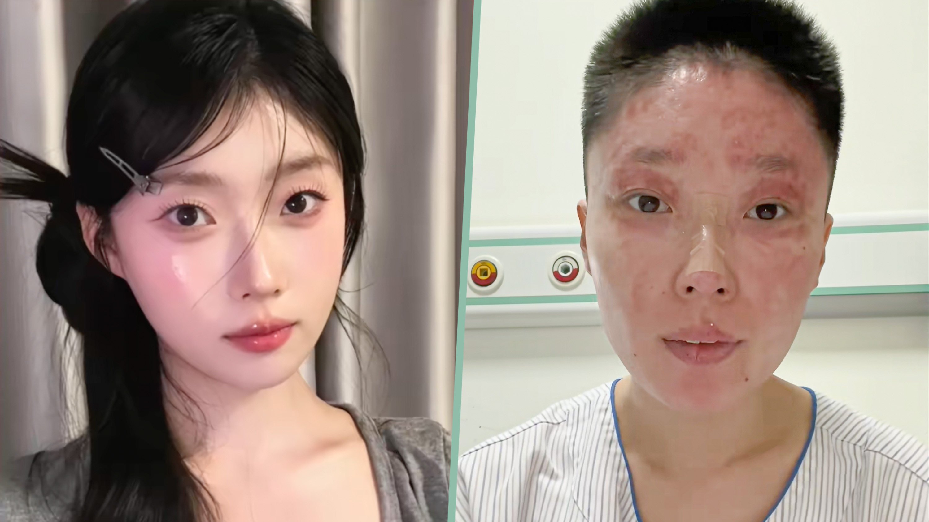 A model and make-up artist survived a gas explosion at her home in which she suffered 14 per cent burns and her parents were severely injured. Photo: SCMP composite/Douyin