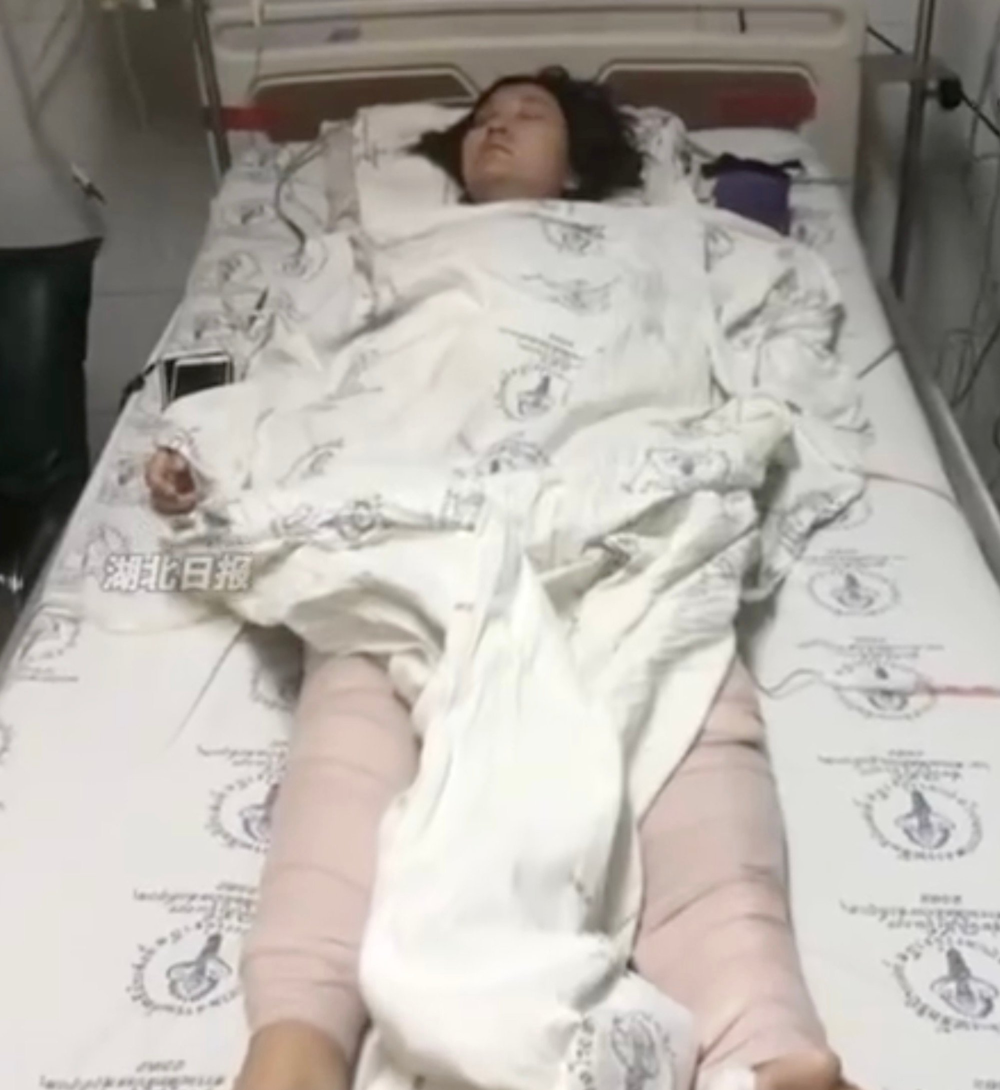 At that time, Wang, above, was pregnant and had endured 17 bone fractures, multiple surgeries, over 100 steel pins, and 200 stitches. Photo: Handout