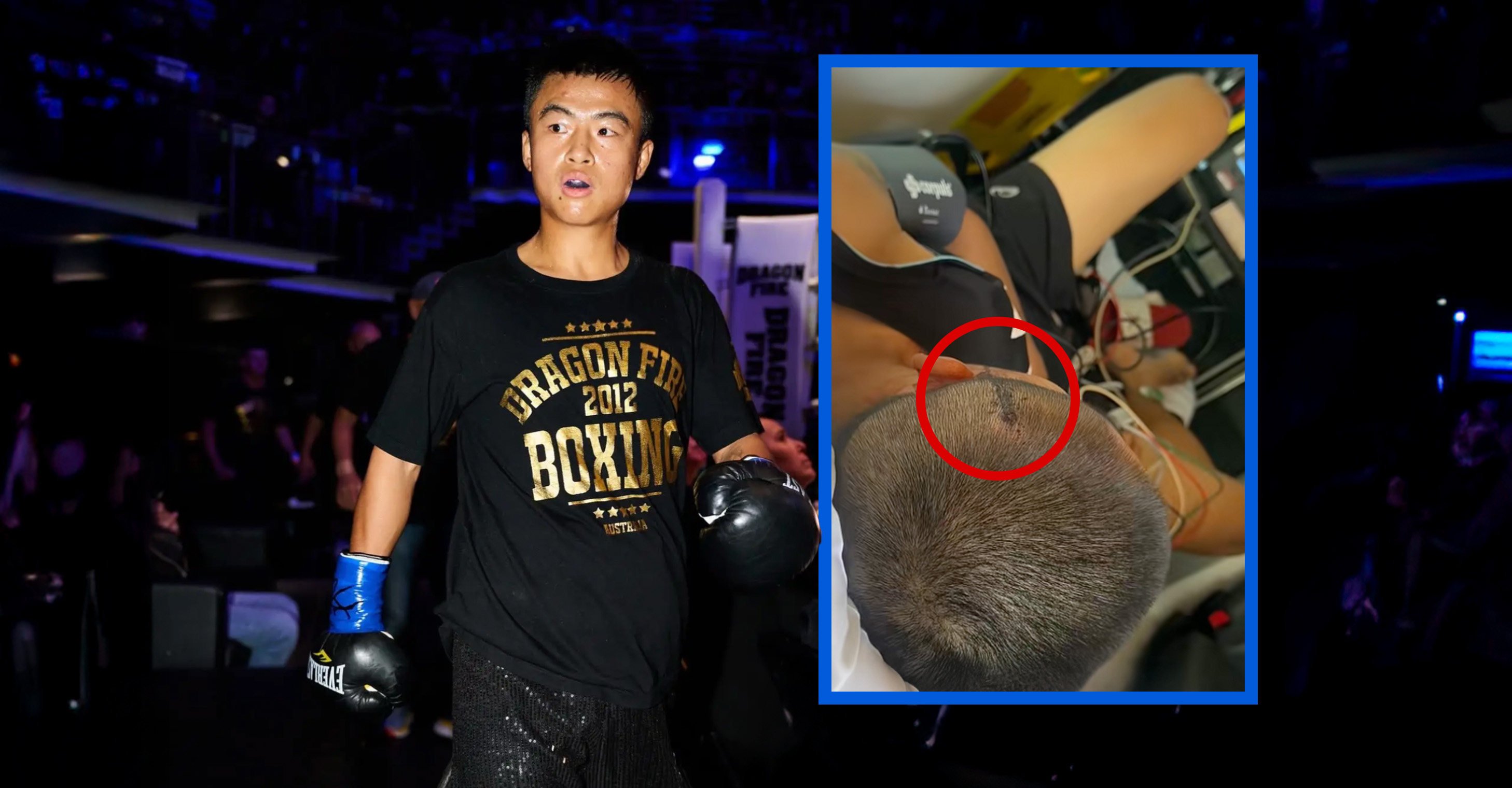 A Chinese boxing champion who, along with his wife, was attacked in Australia, says he is going to divorce his partner because he failed to protect her. Photo: SCMP composite/Douyin