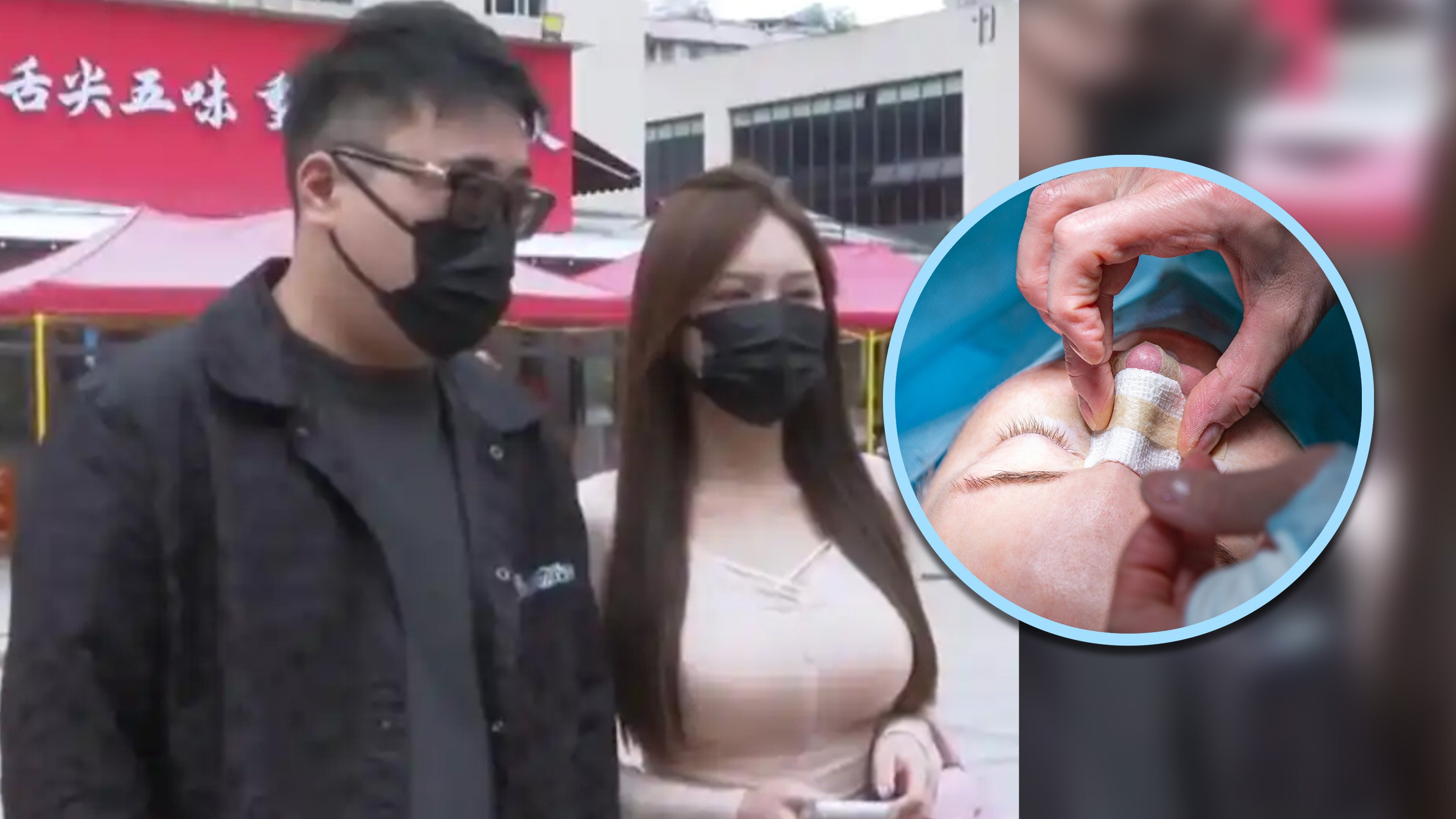 A Chinese businessman lost more than US$140,000, which he had entrusted to his girlfriend for safekeeping, after she spent the money on plastic surgery. Photo: Shutterstock/Baidu