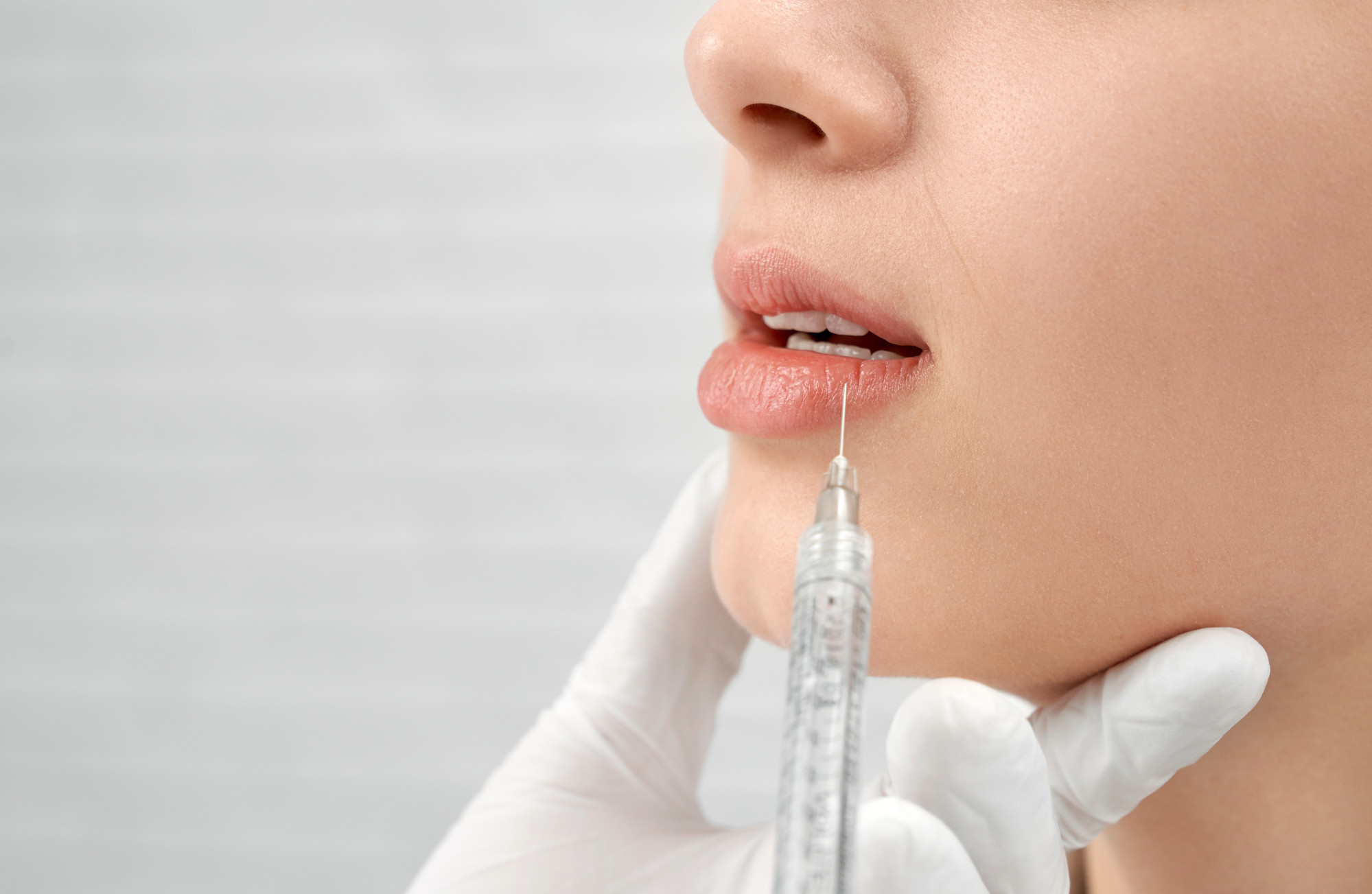 One of the procedures Min underwent was to have her lips made plump to make her look “wealthy”. Photo: Shutterstock