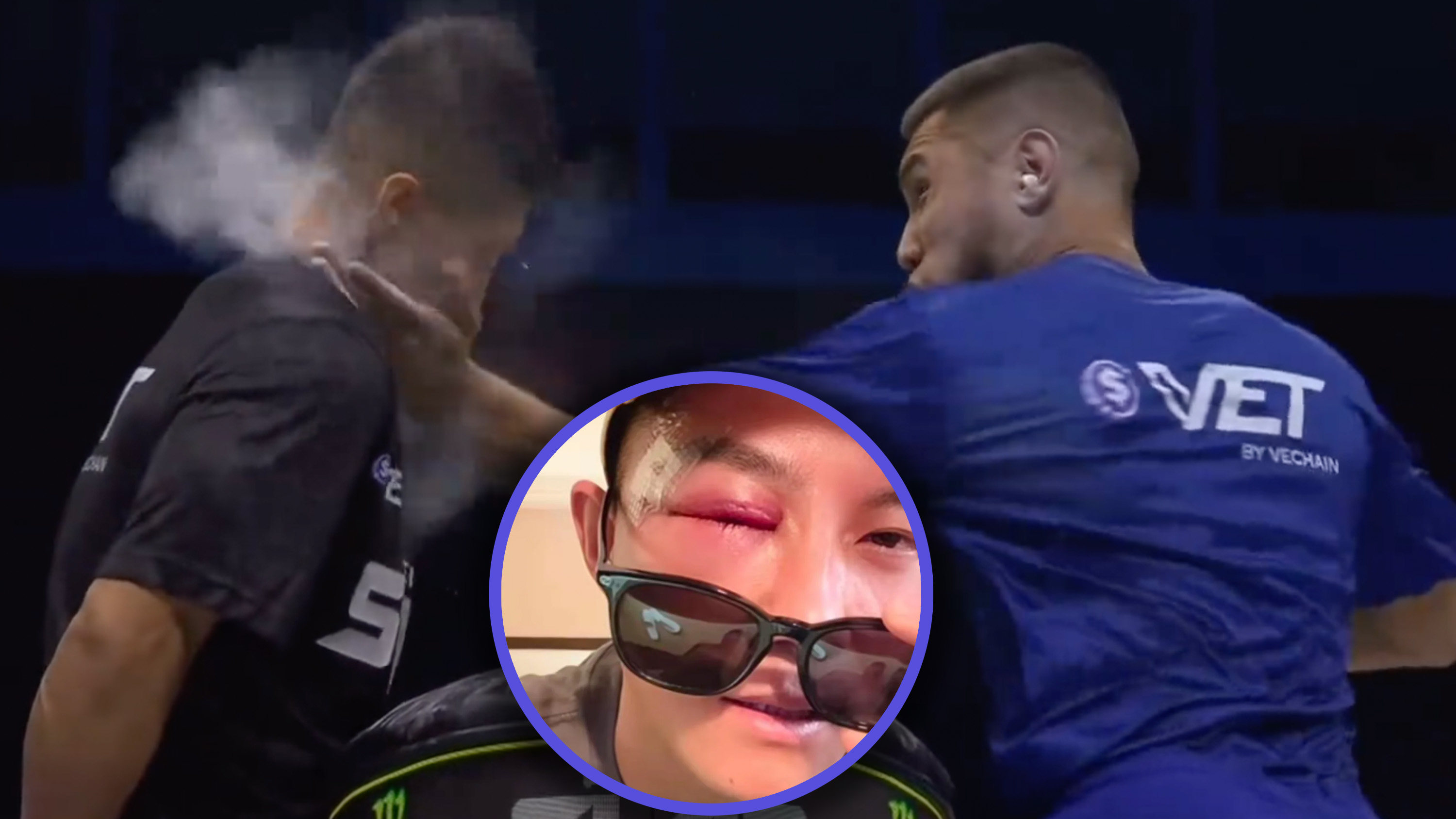 China’s first contestant in a Power Slap competition was knocked unconscious and needed five stitches in a face wound. Photo: SCMP composite/Douyin/RedNote
