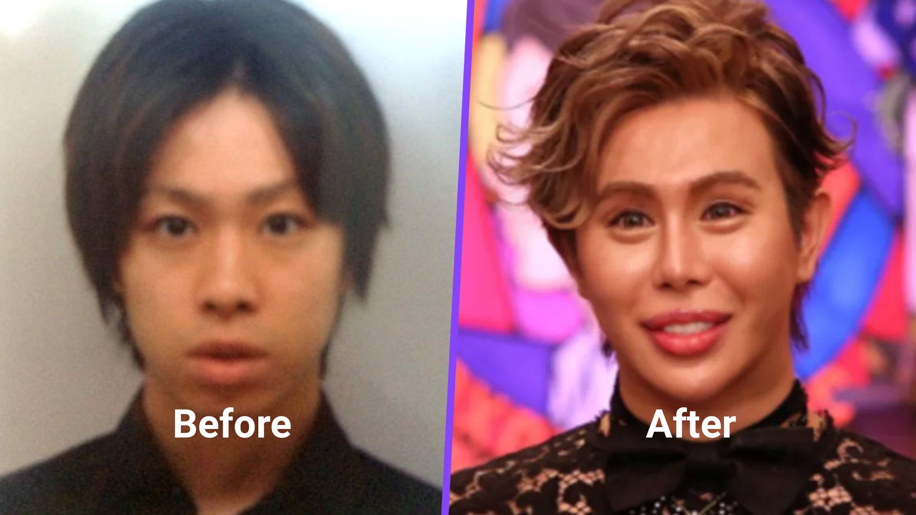 A Japanese man has spent US$651,000 on plastic surgery to become “the most beautiful person in the world” after enduring years of bullying because of his appearance. Photo: SCMP composite/QQ.com
