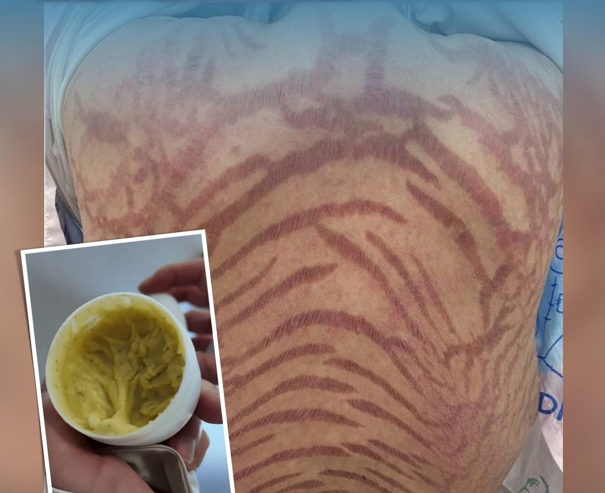 The seller asserted that the cream, above, was composed of “pure traditional Chinese medicine” and had the ability to “cure all types of skin diseases”. Photo: Douyin