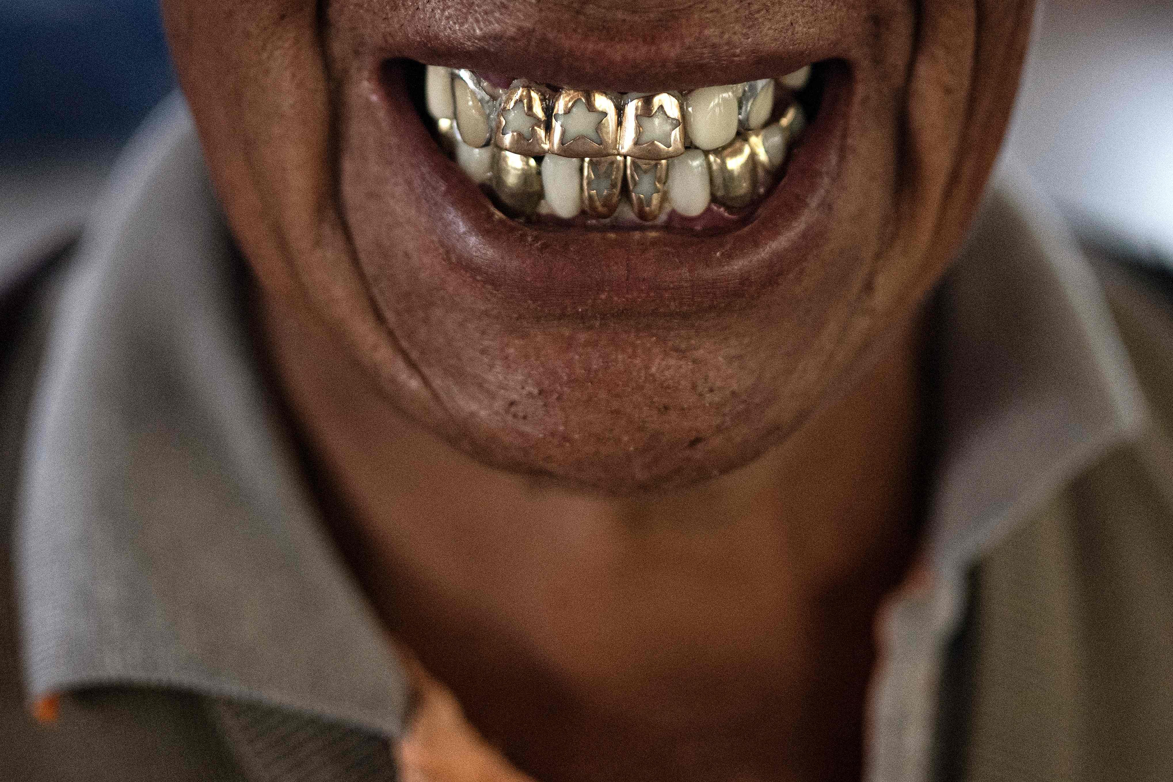A man in Bolivia shows off his gold decorated teeth. Photo: AFP