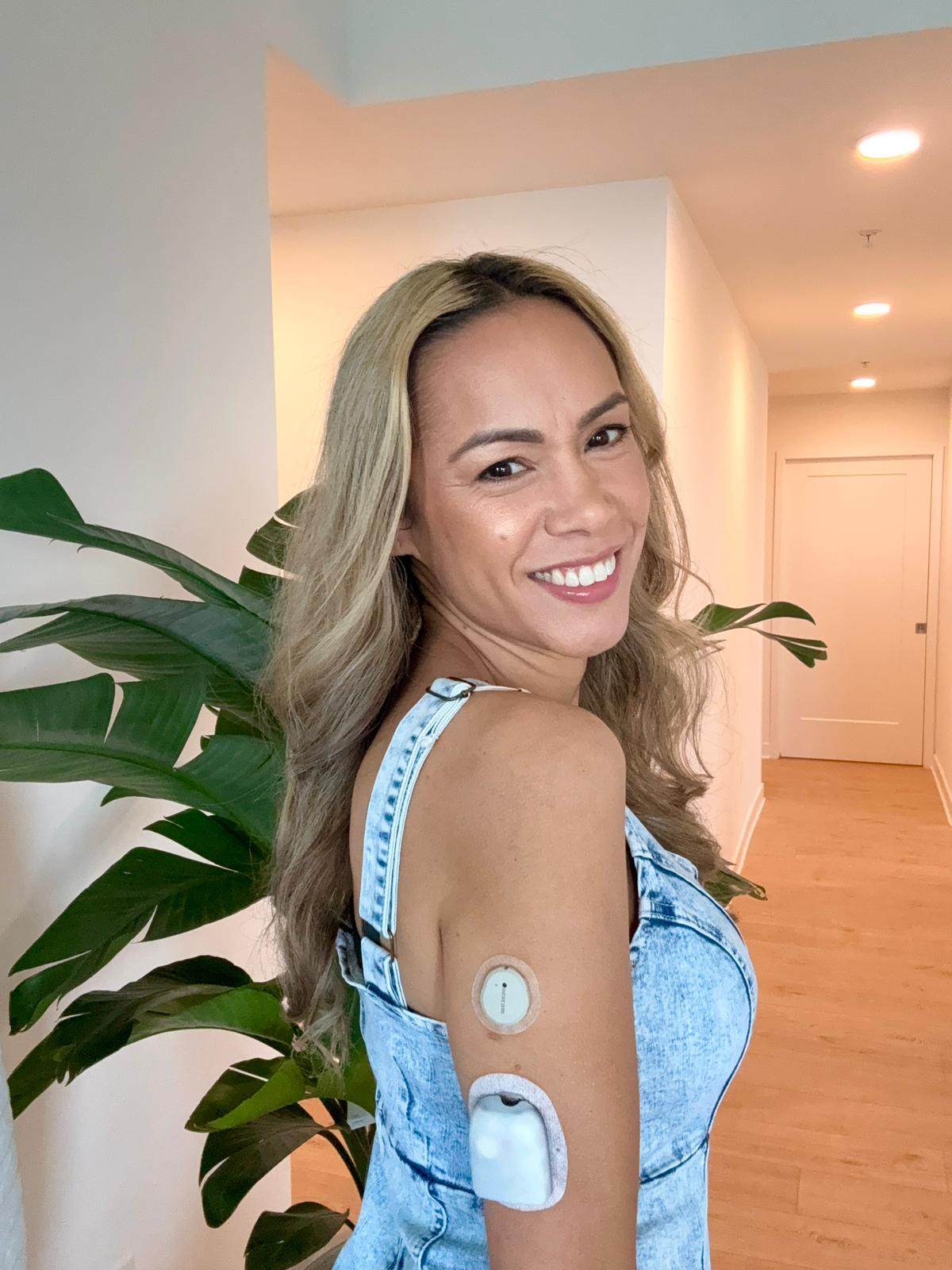 Michelle Hale wears her glucose monitor on her bare arm, helping to break the stigma surrounding the use of such wearable medical devices. Photo: Michelle Hale