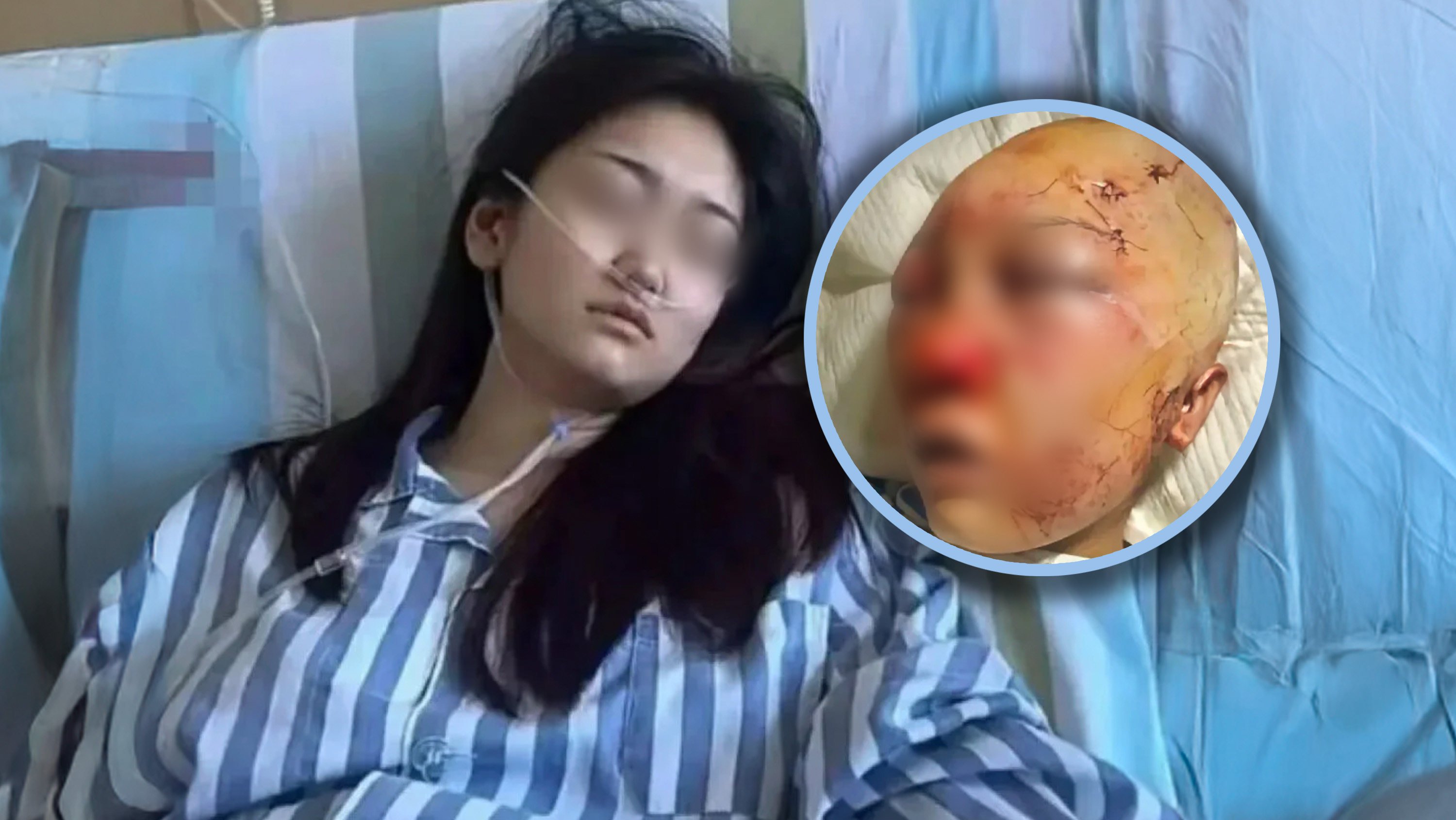 A young woman in China who was brutally attacked in a public toilet three years ago has been diagnosed with leukaemia and is desperately seeking online donations to pay for her medical treatment. Photo: RedNote/Douyin