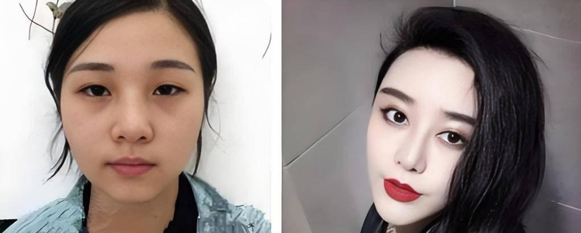 Cosmetic transformation: He before and after almost 40 rounds of surgery. Photo: Baidu Cosmetic transformation: He before and after almost 40 rounds of surgery. Photo: Baidu
