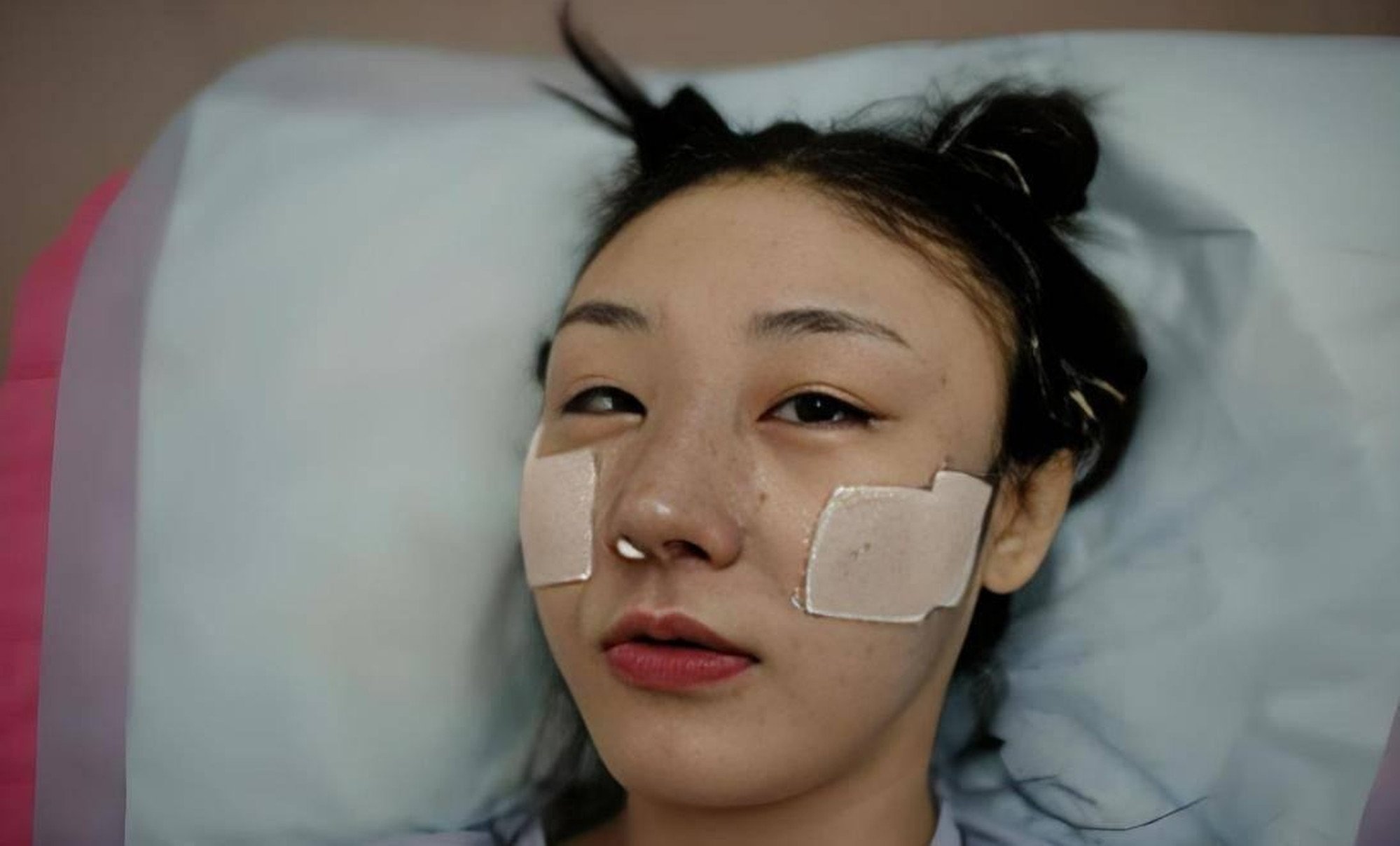 He after one of her procedures. She endured a lot of pain to look like Fan Bingbing. Photo: Baidu He after one of her procedures. She endured a lot of pain to look like Fan Bingbing. Photo: Baidu