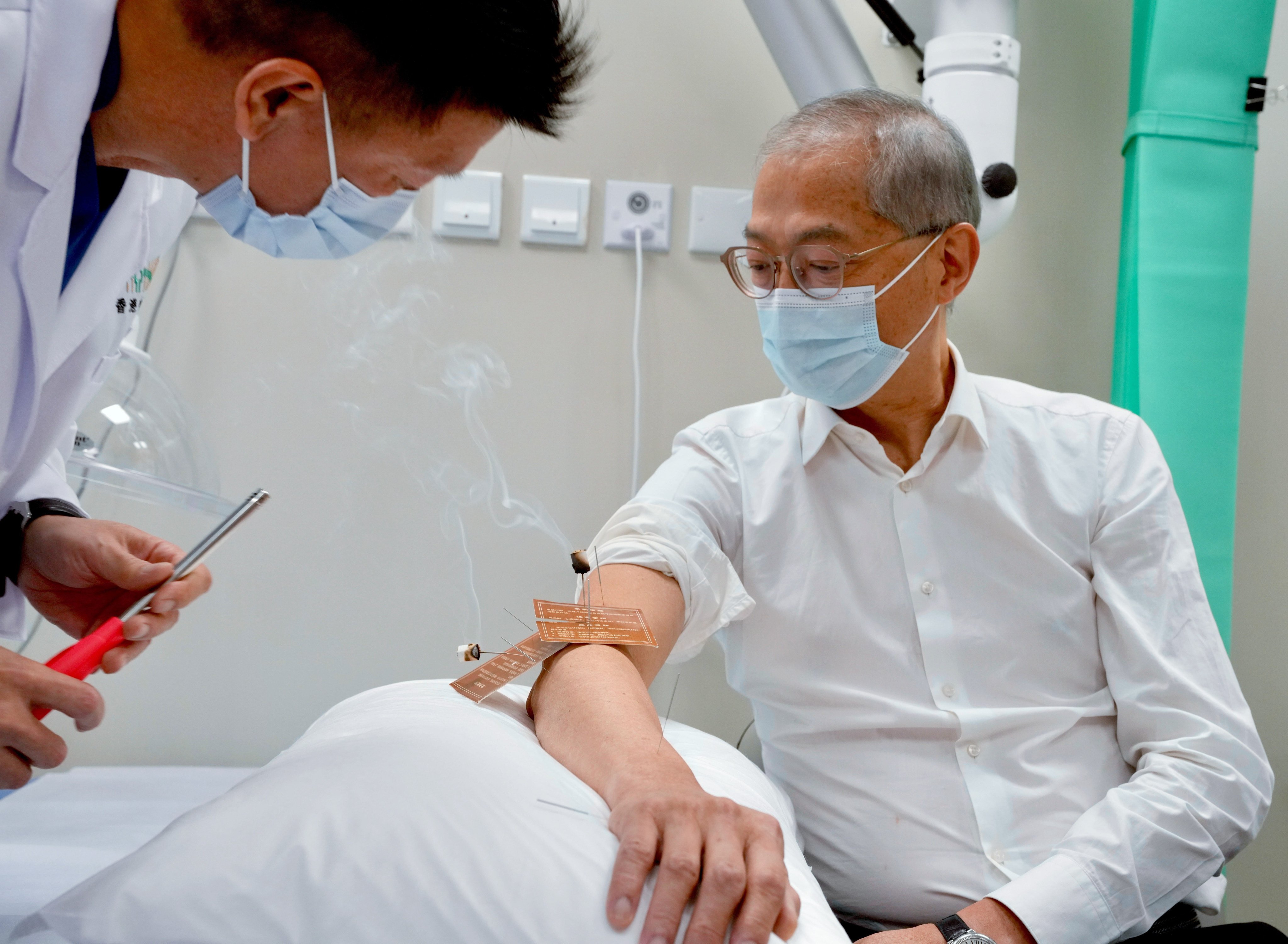Secretary for Health Lo Chung-mau receives moxibustion therapy at the new Chinese medicine hospital in Tseung Kwan O. Photo: SCMP Pictures
