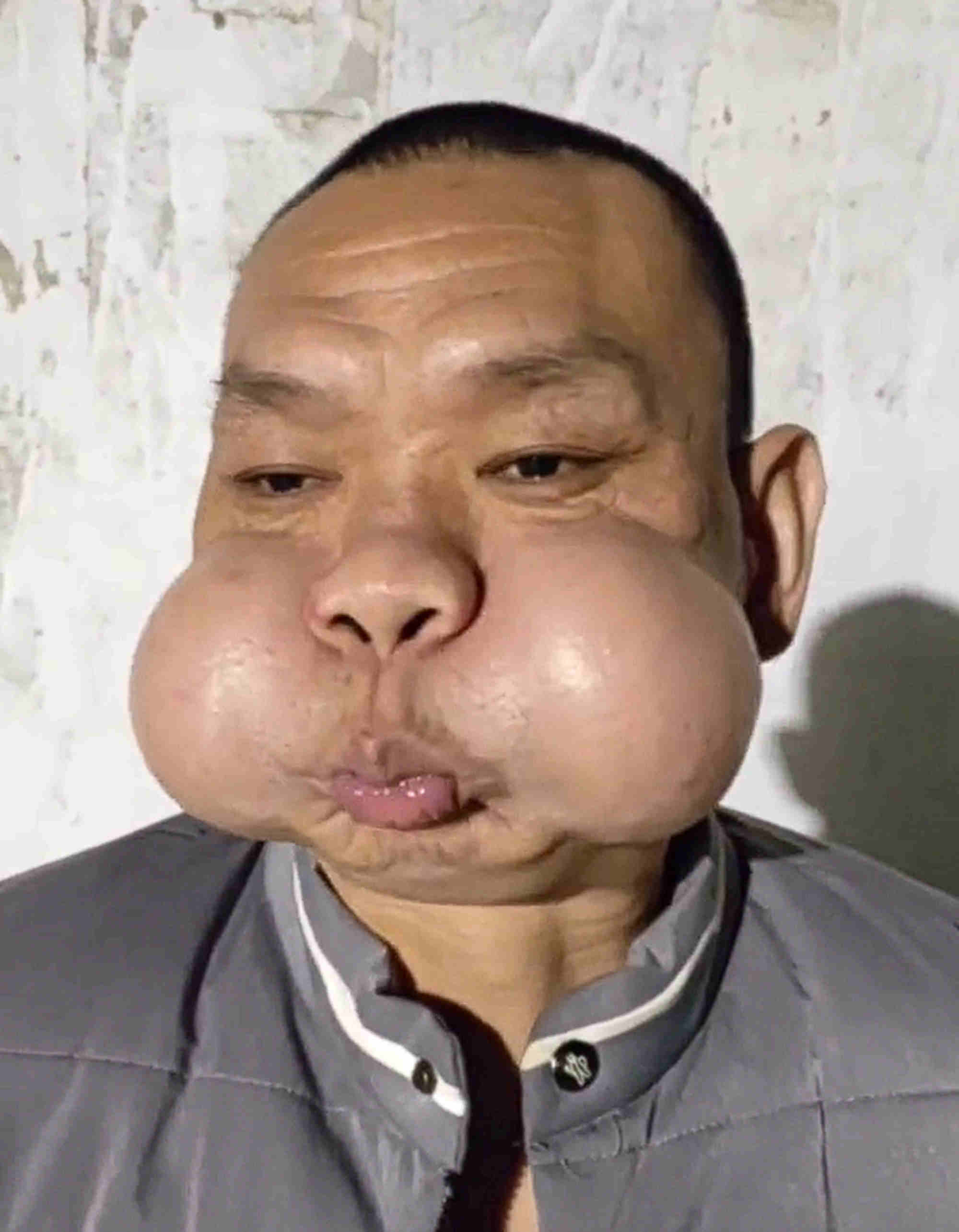 Three decades of work have left Zhang’s face muscles deformed and damaged. Photo: Sina Three decades of work have left Zhang’s face muscles deformed and damaged. Photo: Sina
