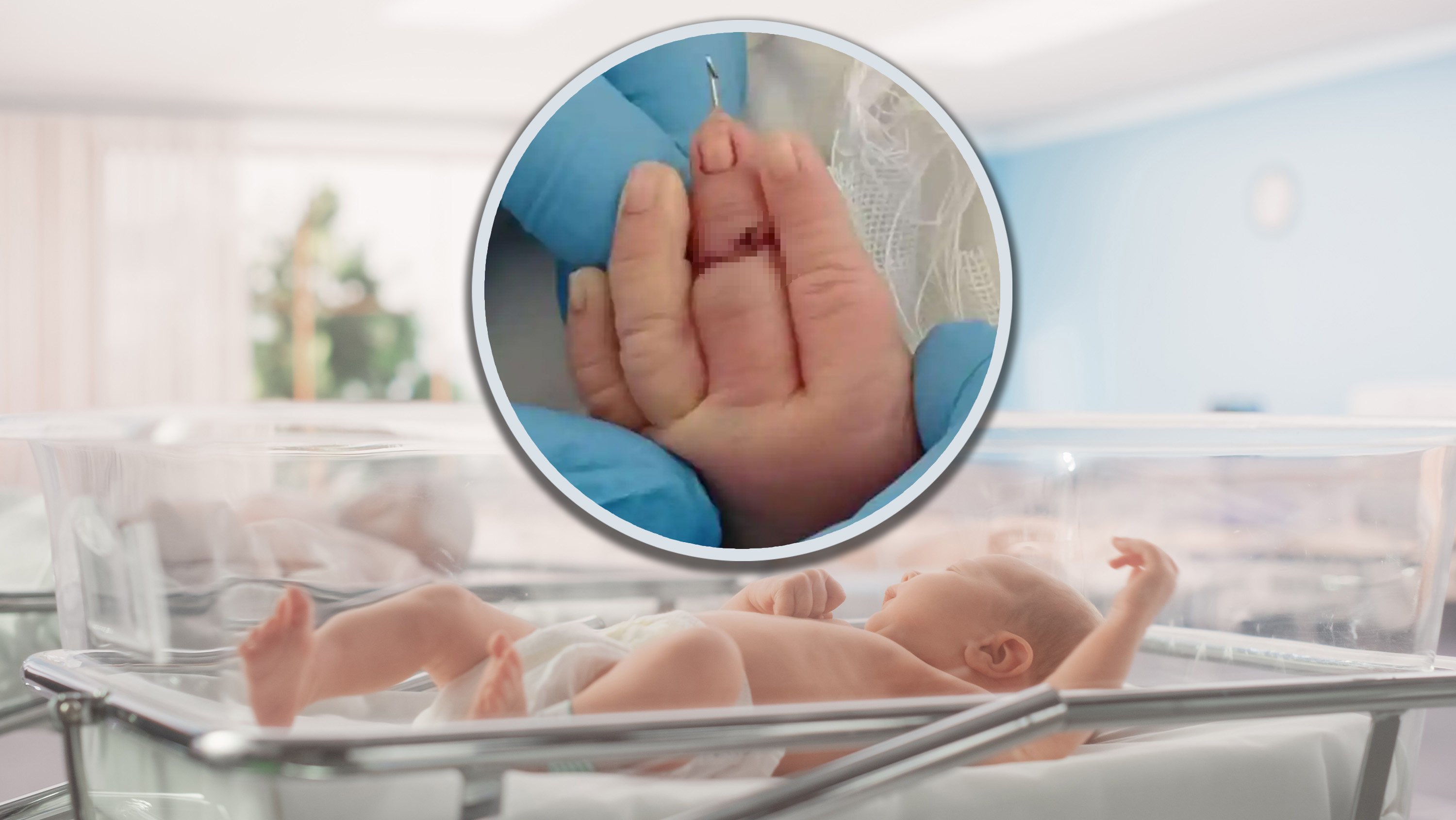 A Chinese midwife accidentally severed a baby’s middle finger during a caesarean section and the infant was transferred to a larger hospital for surgery. Photo: SCMP composite/Shutterstock/Baidu