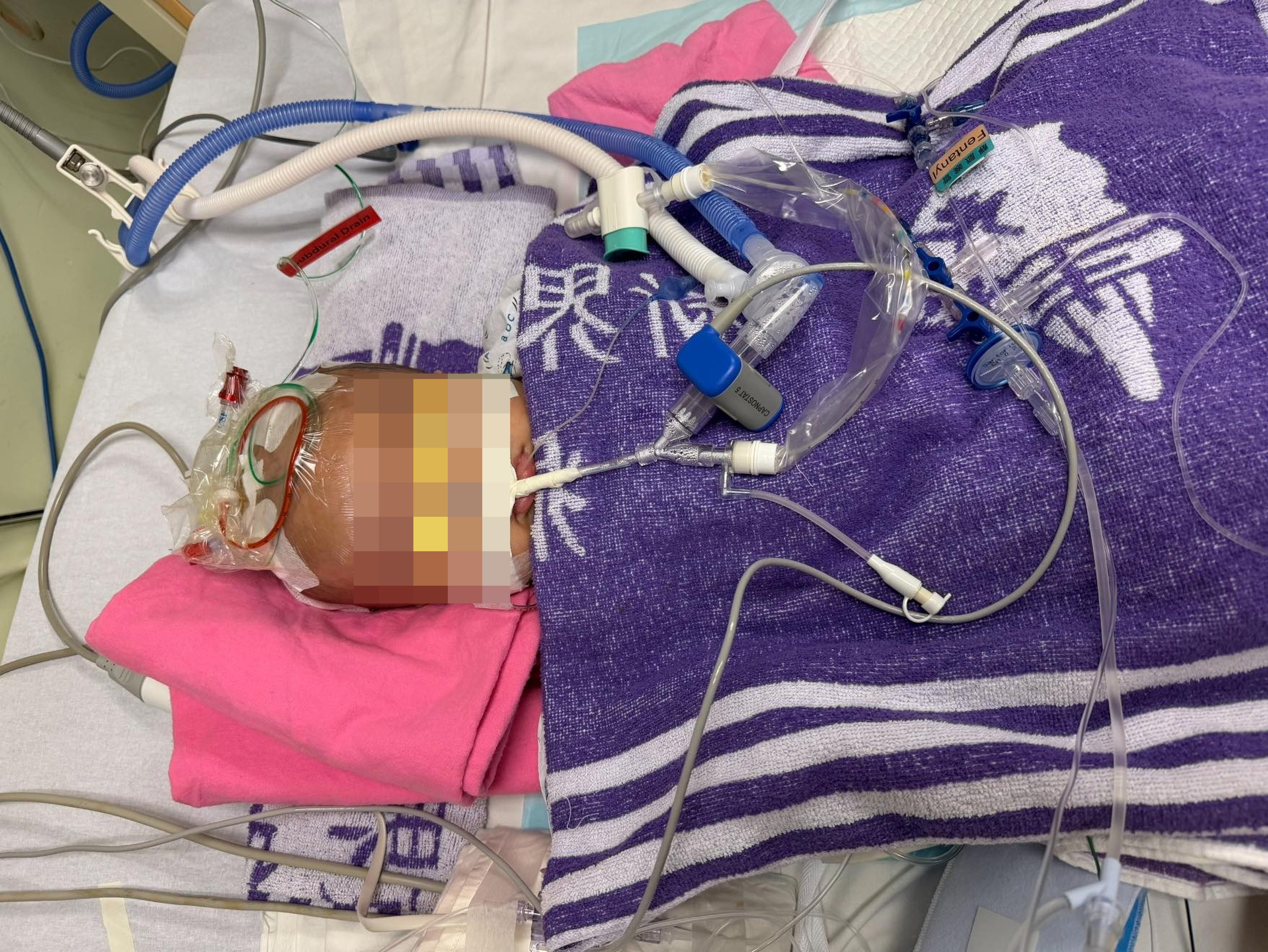 The four-month-old is currently in the intensive care unit of Prince of Wales Hospital after undergoing emergency brain surgery. Photo: Handout