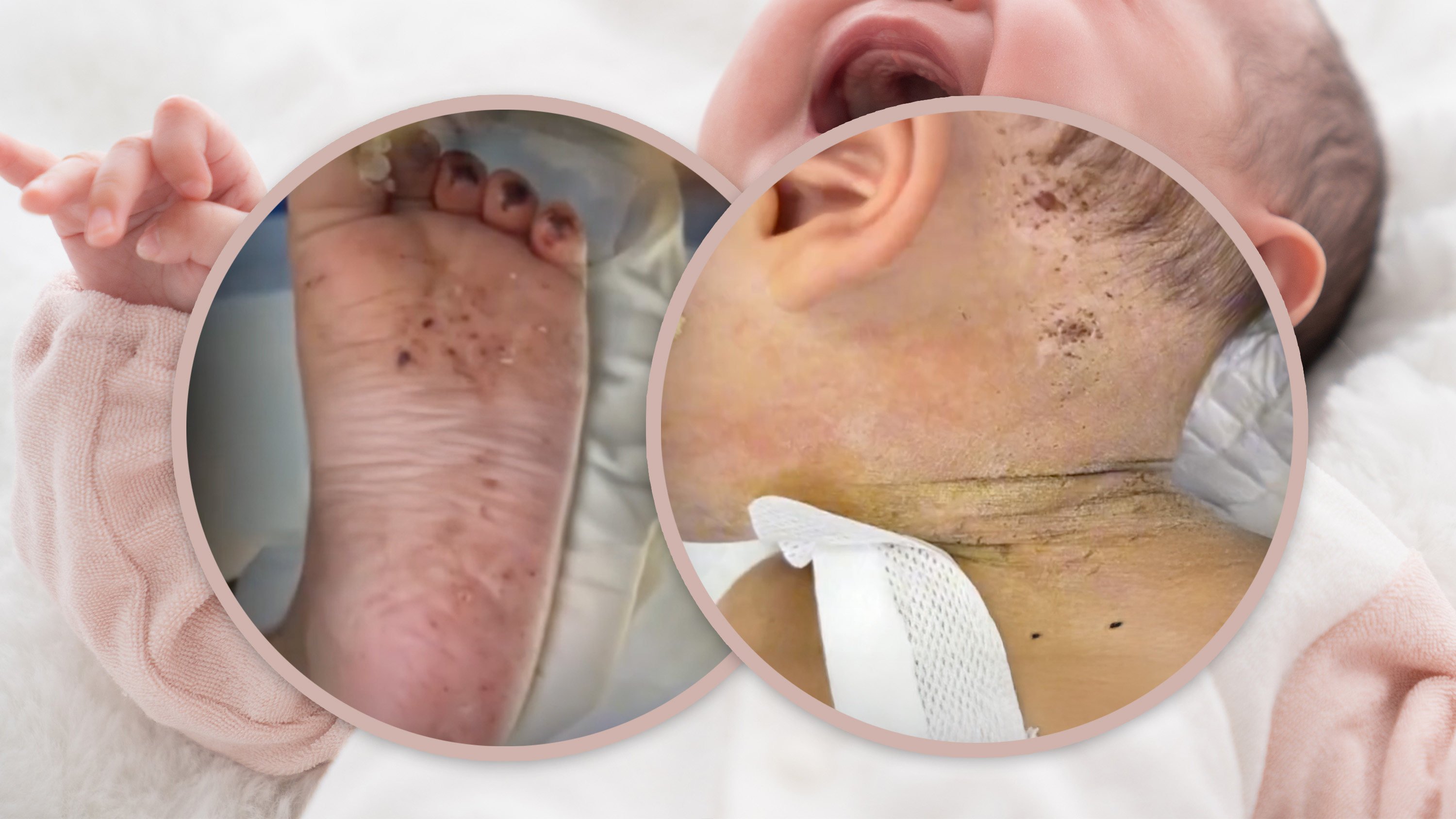 A baby boy in China was rushed to hospital covered in needle marks after being brutally punished by his mother, who stabbed him repeatedly for misbehaving. Photo: SCMP composite/Shutterstock/Douyin