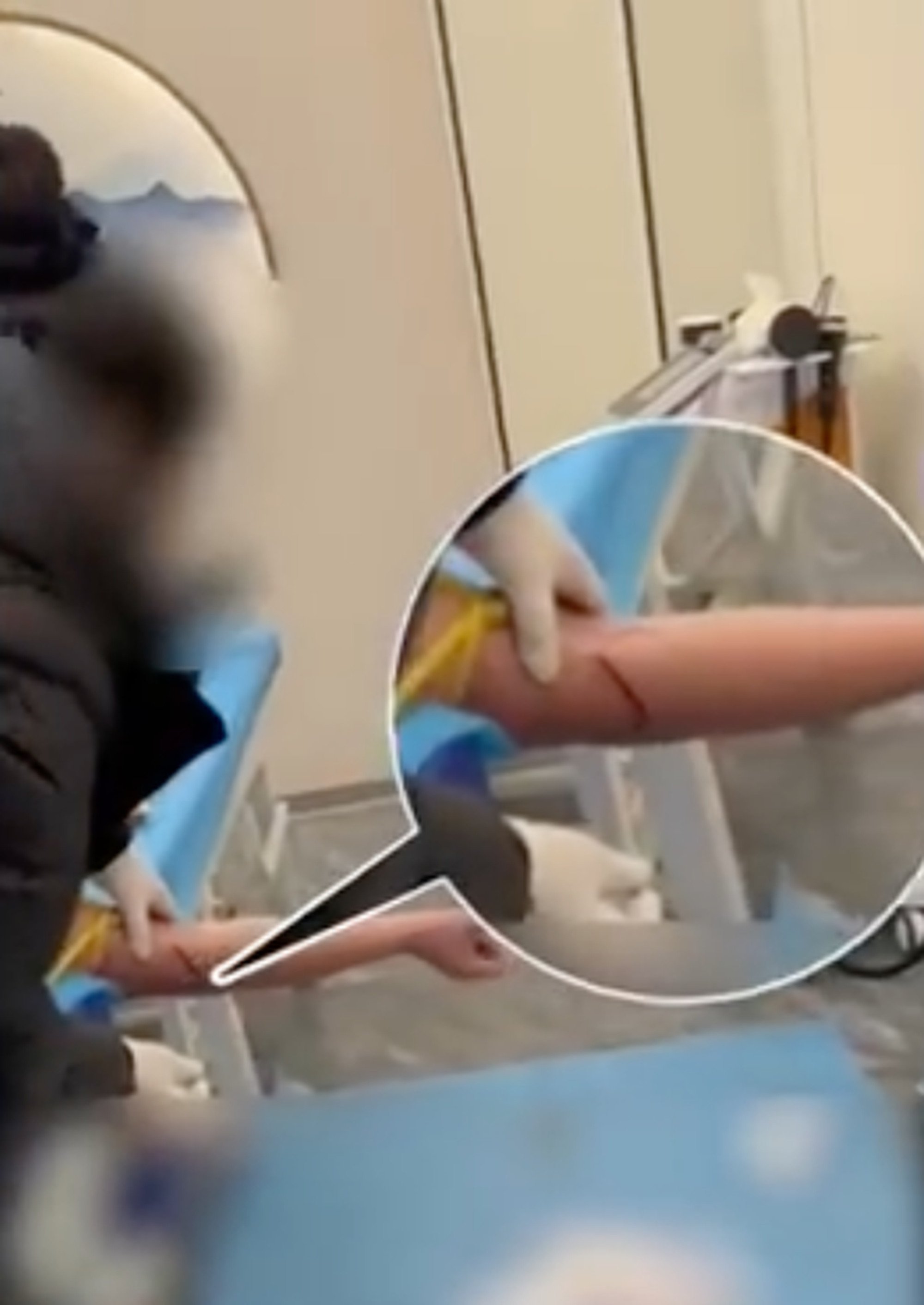 Seconds after the “treatment” gets under way, blood can be seen dripping from the man’s arm. Photo: Weibo Seconds after the “treatment” gets under way, blood can be seen dripping from the man’s arm. Photo: Weibo